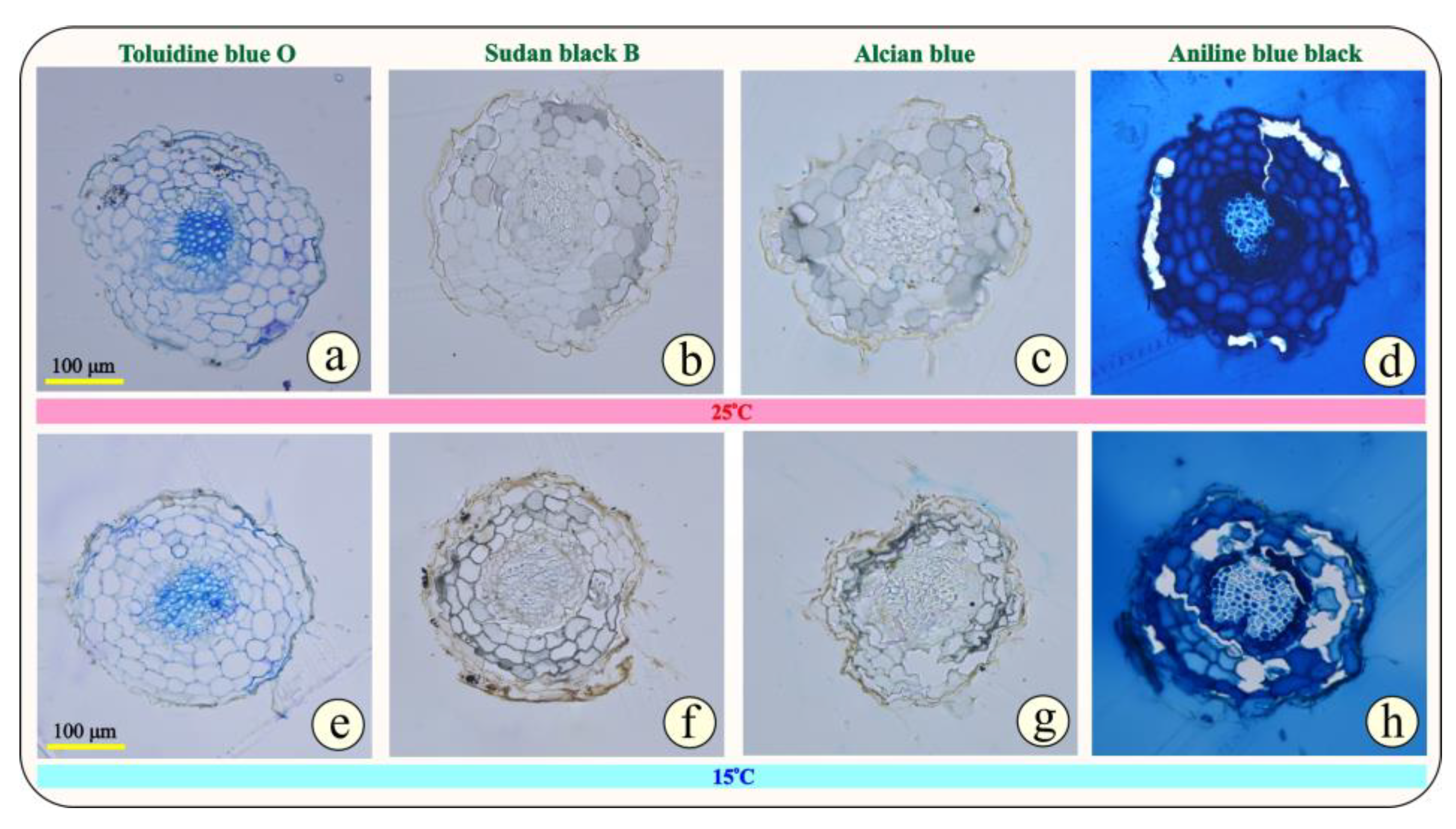 Morphological and Phylogenetic Analyses Reveal Three New Species of  Distoseptispora (Distoseptisporaceae, Distoseptisporales) from Yunnan, China