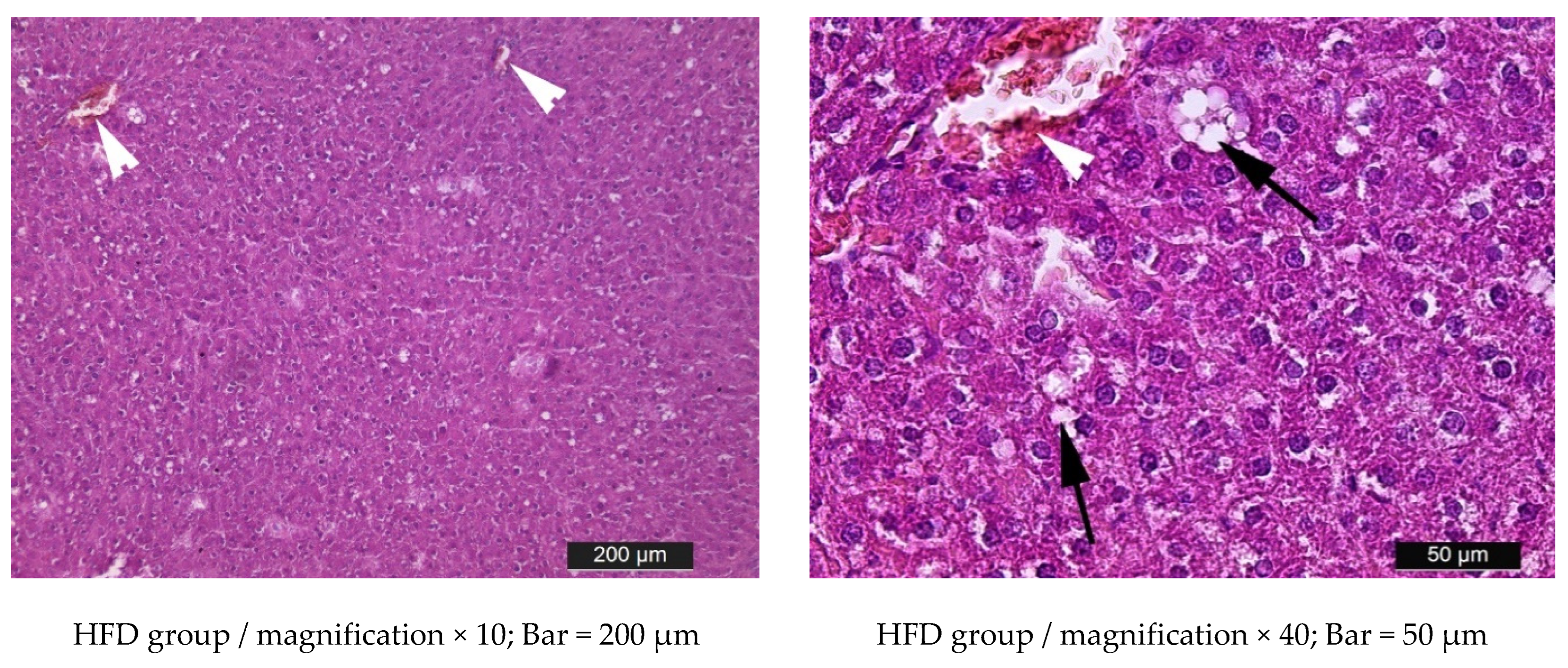 Metabolites 15 00656 g012a Metabolites 15 00656 g012a