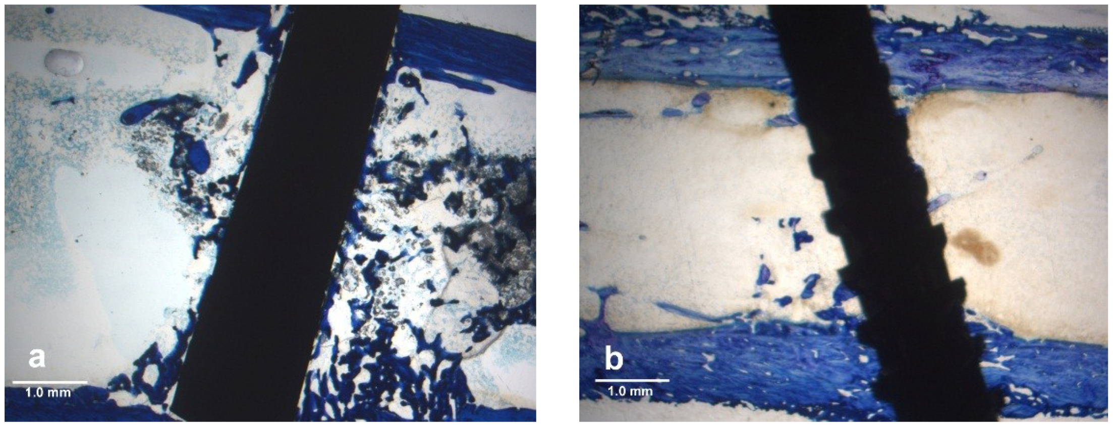 Metals 04 00549 g003 1024