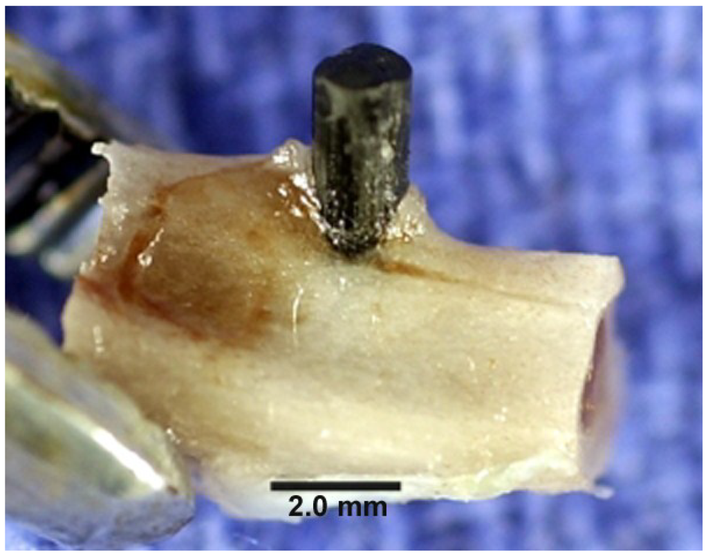 Metals Free FullText Titanium Implant Osseointegration Problems