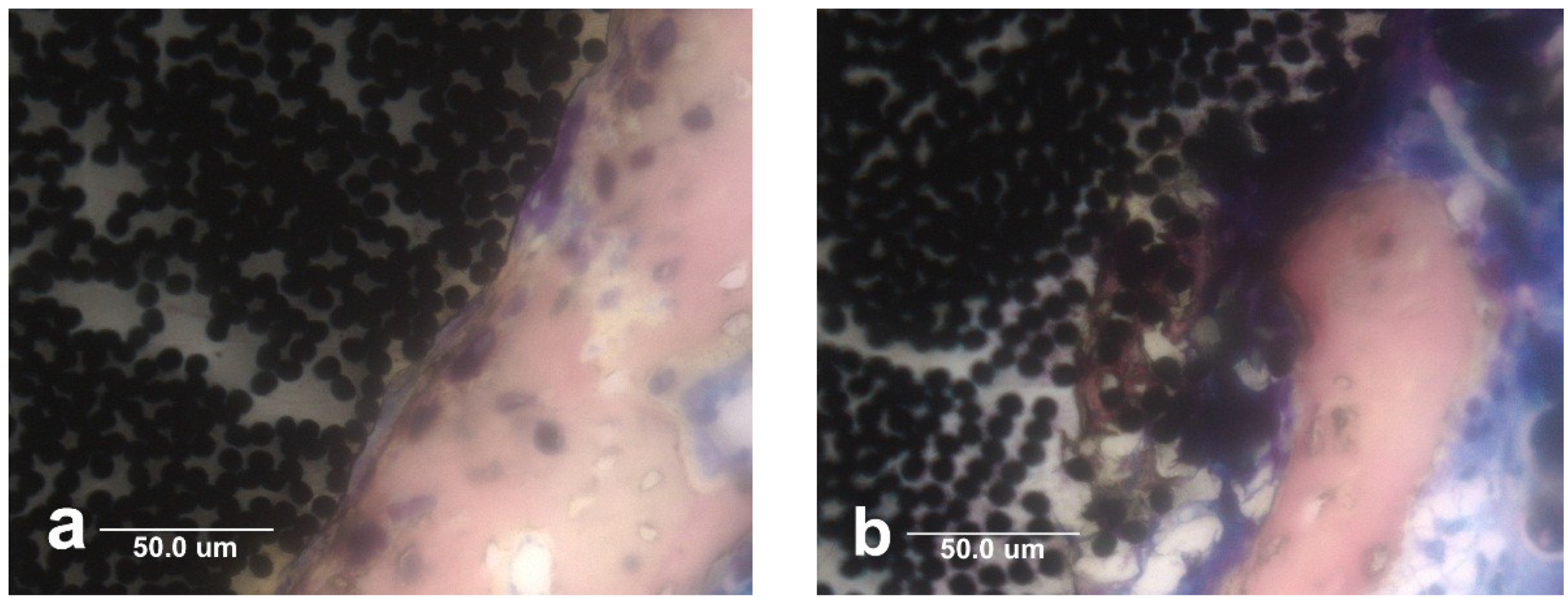 Metals 04 00549 g010 1024