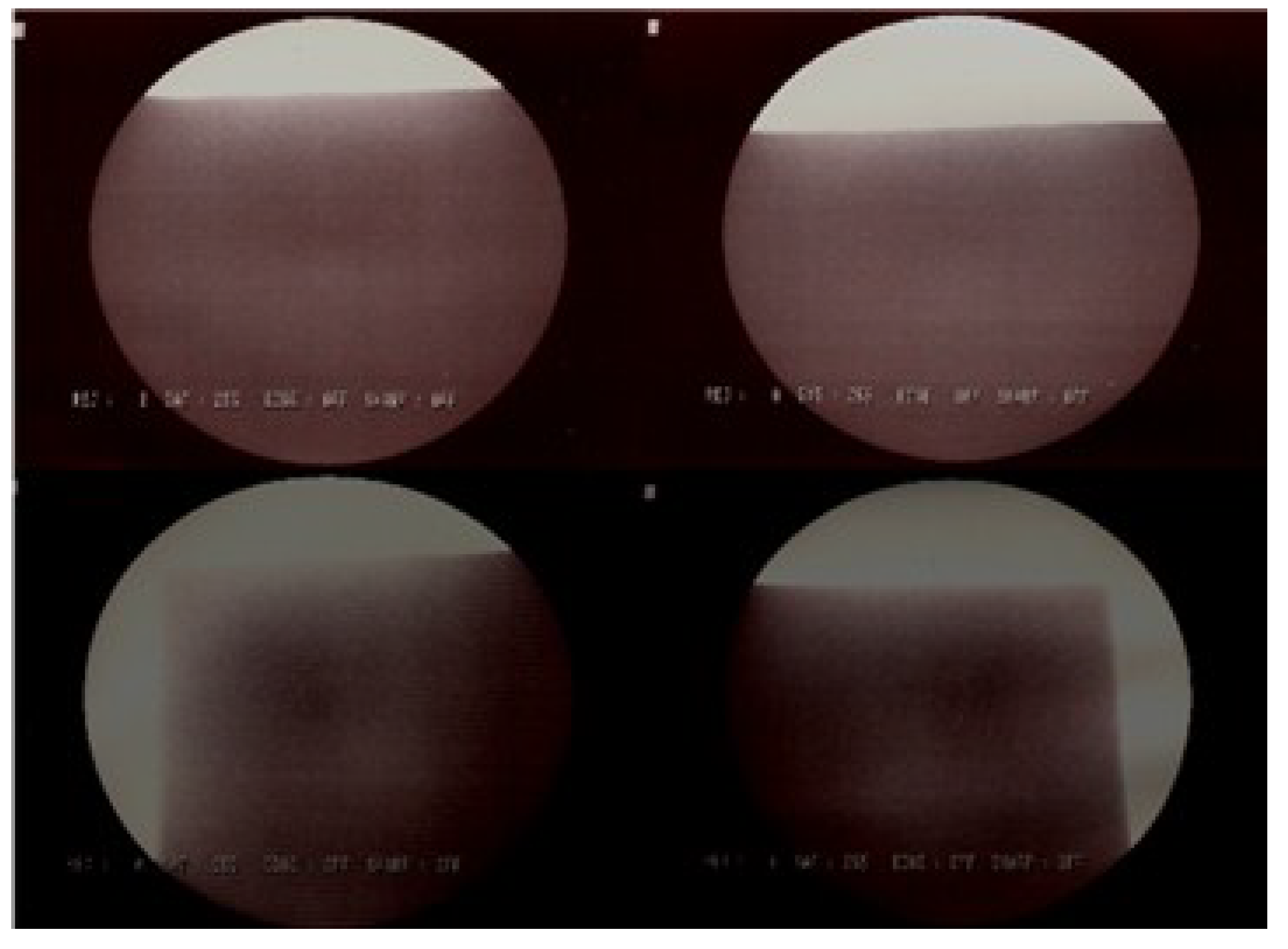 Metals 05 00706 g014 1024