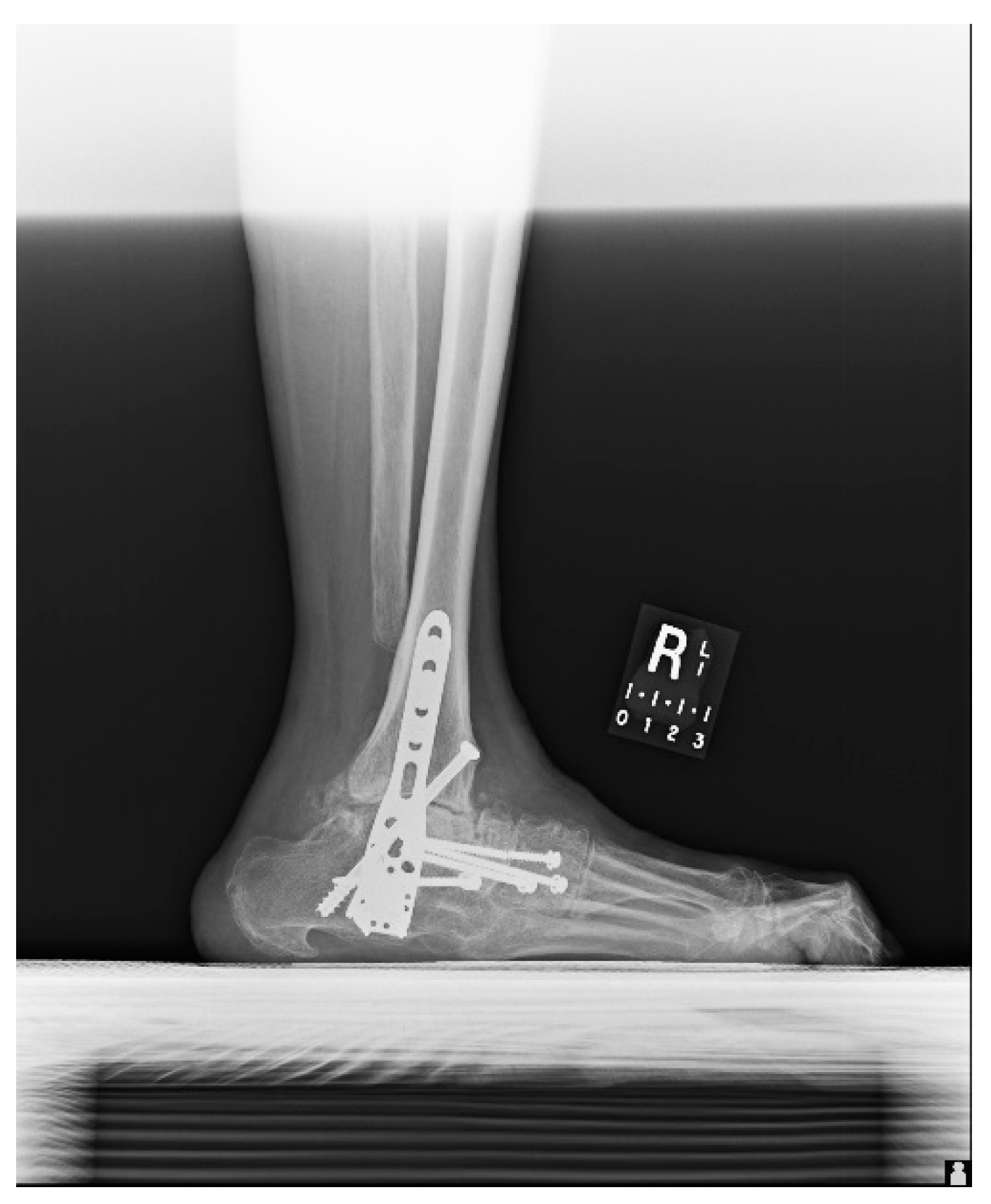 Metals 08 00180 g0a2 Metals 08 00180 g0a2