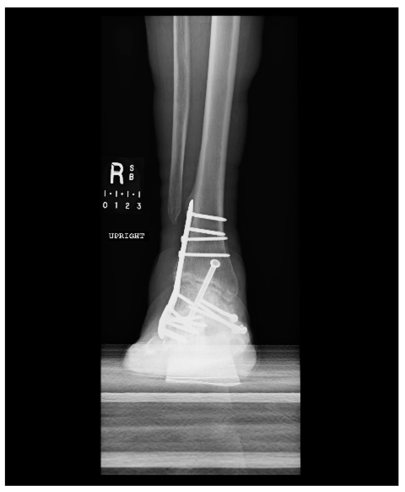 Metals 08 00180 g0a3 Metals 08 00180 g0a3