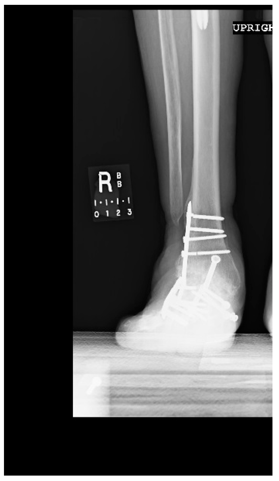 Metals 08 00180 g0a5 Metals 08 00180 g0a5