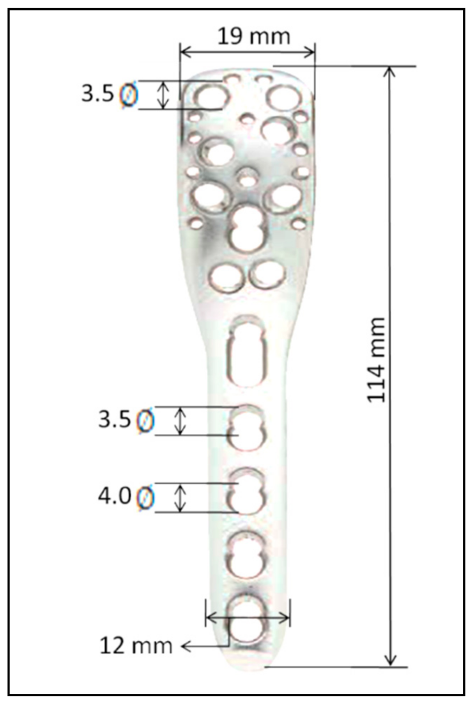 Metals 08 00279 g004