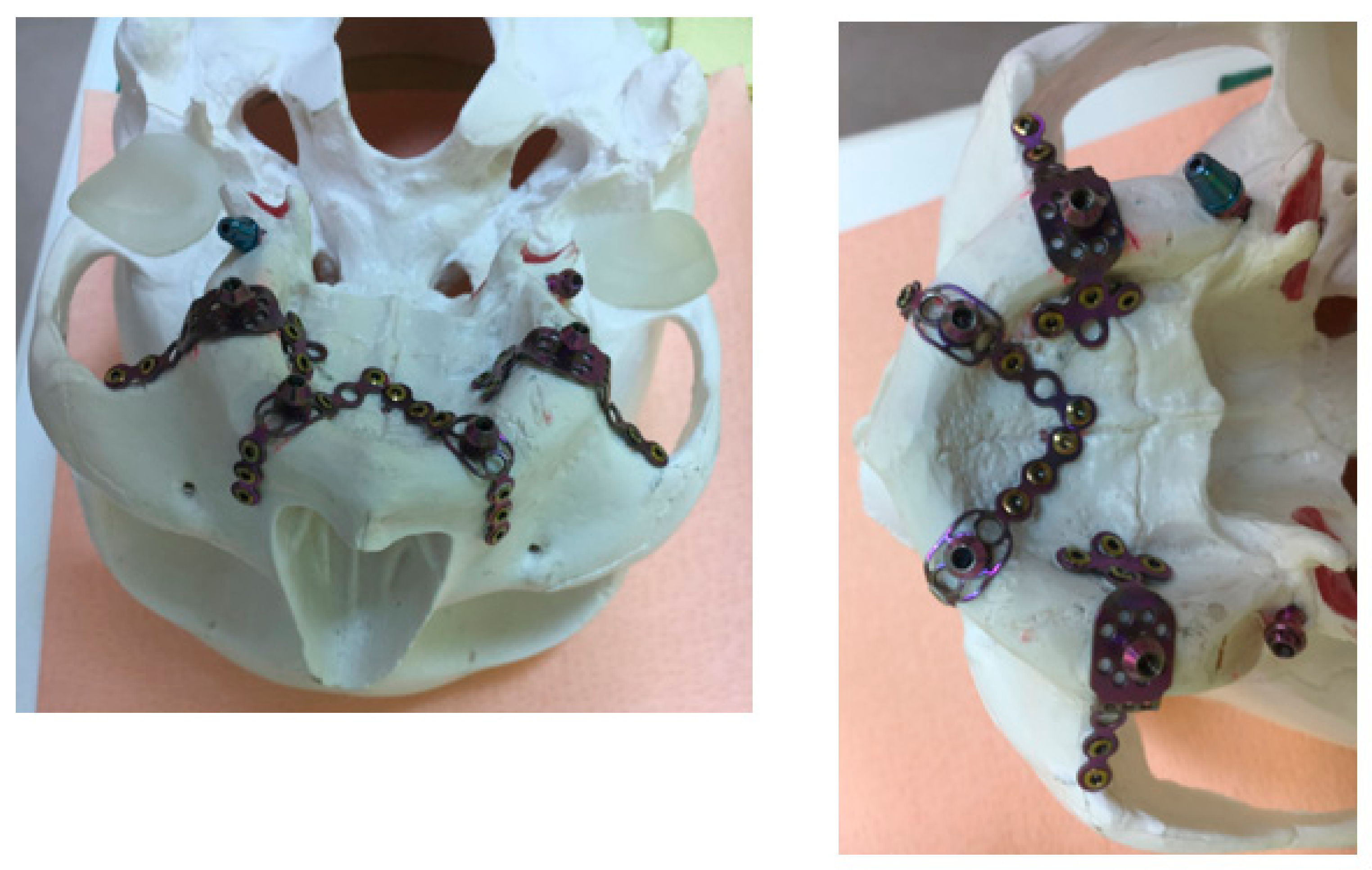 Metals 08 00573 g005