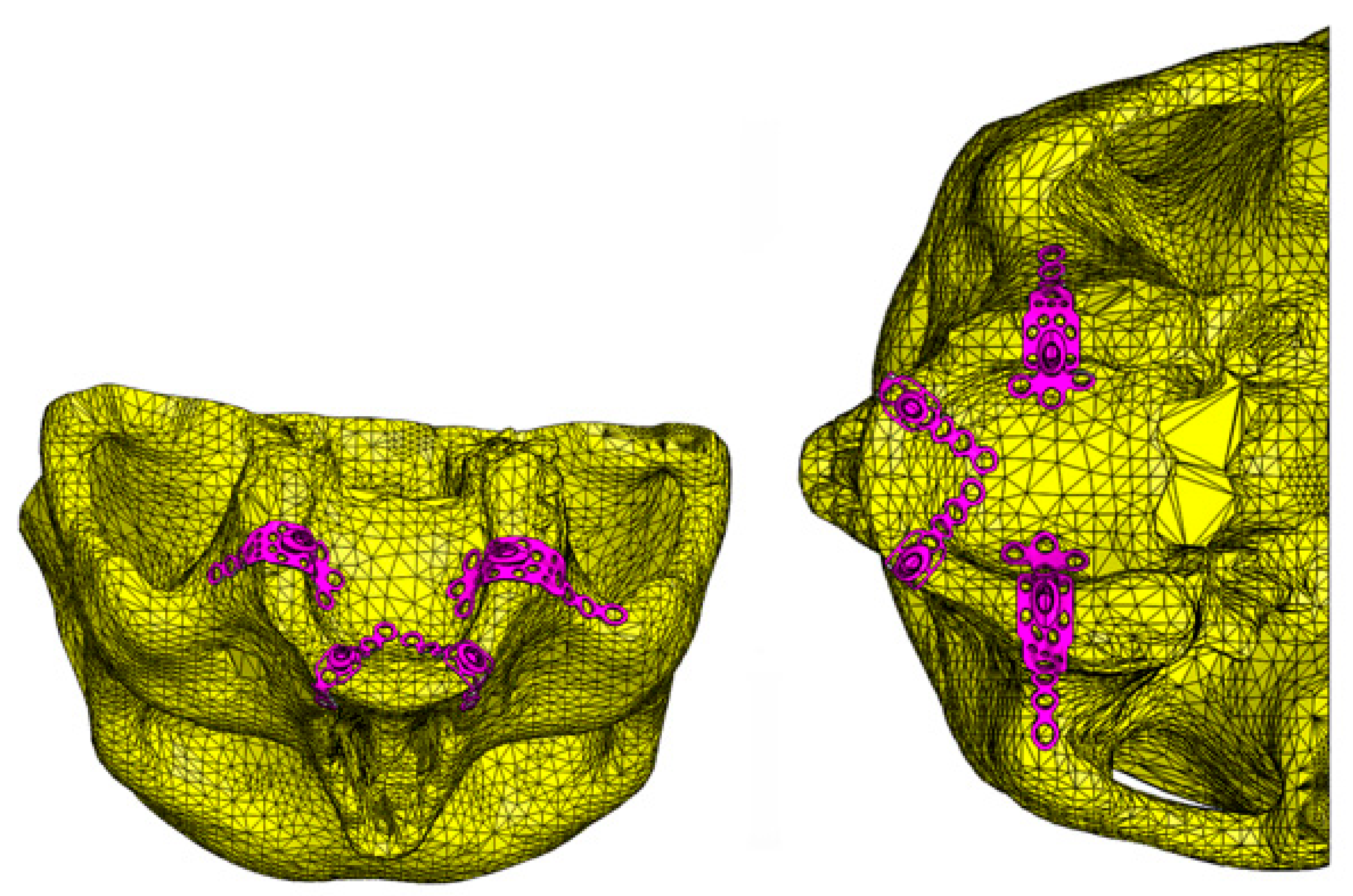 Metals 08 00573 g006