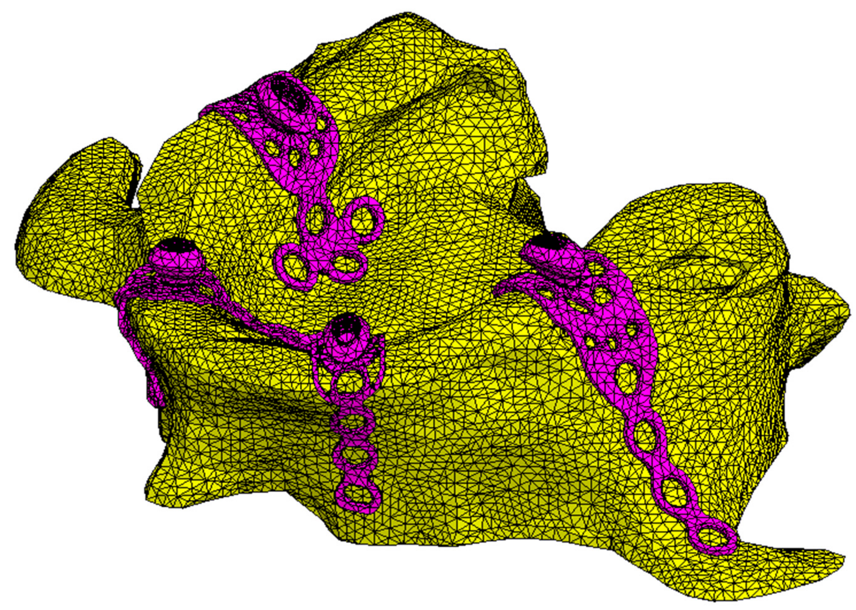 Metals 08 00573 g007