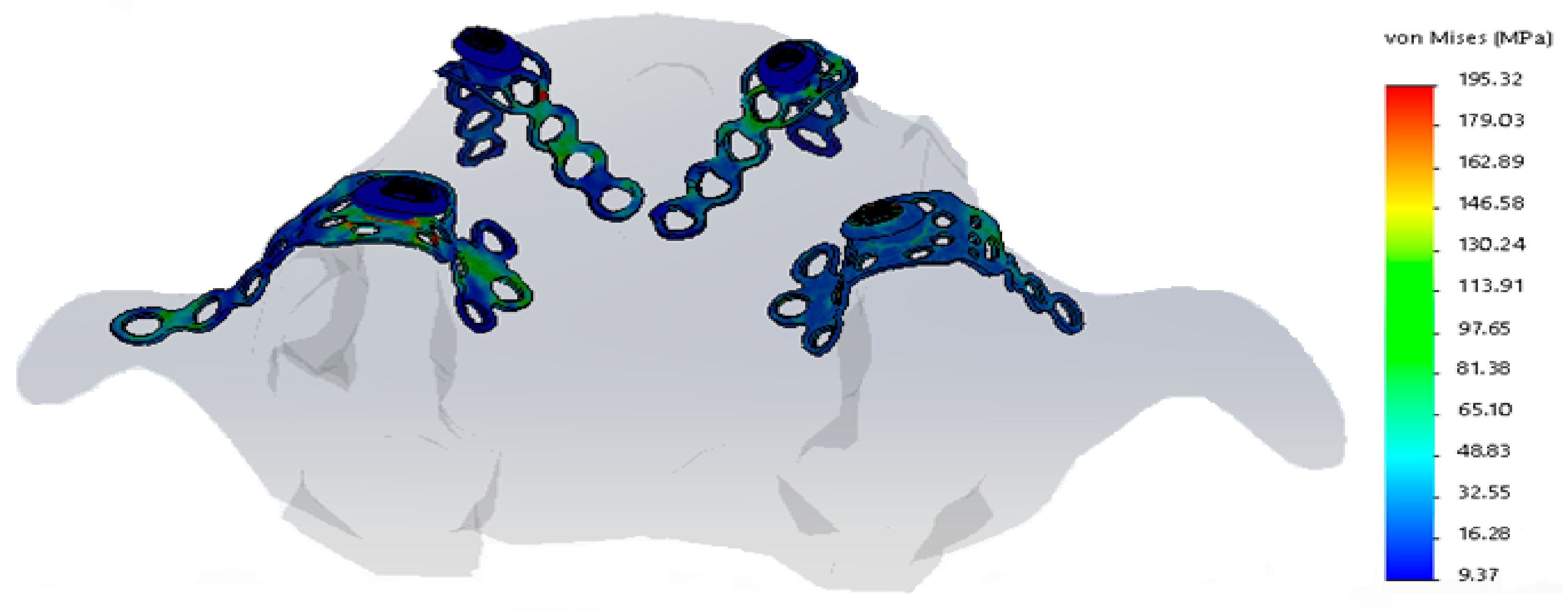 Metals 08 00573 g009