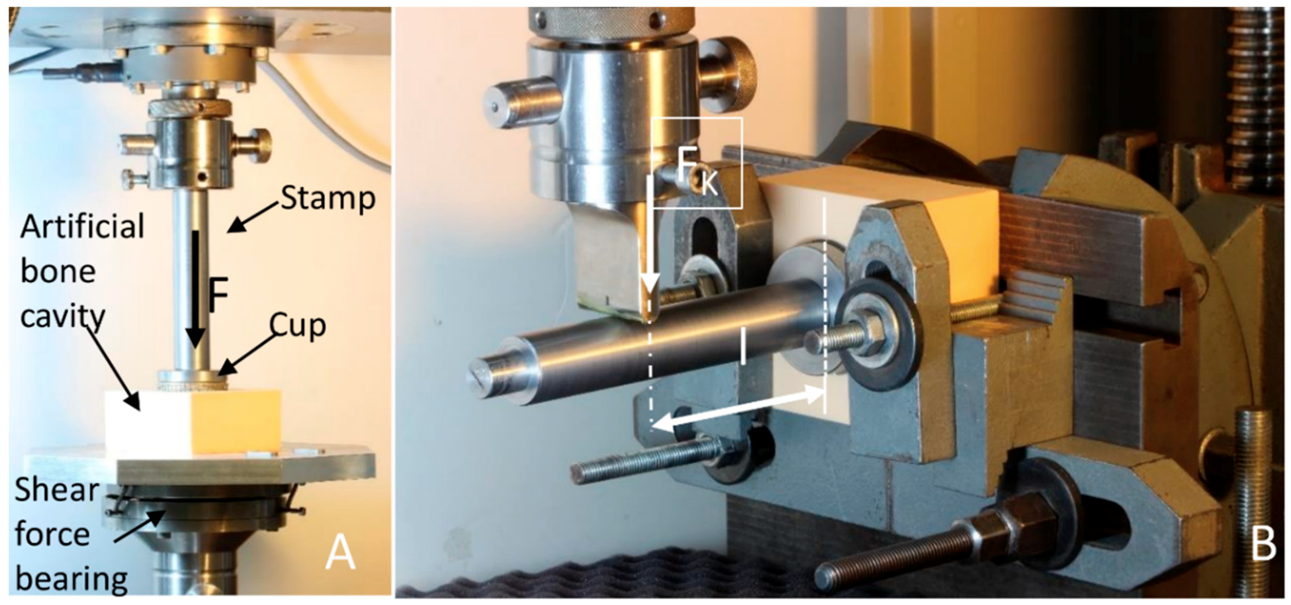 Metals 08 00839 g004