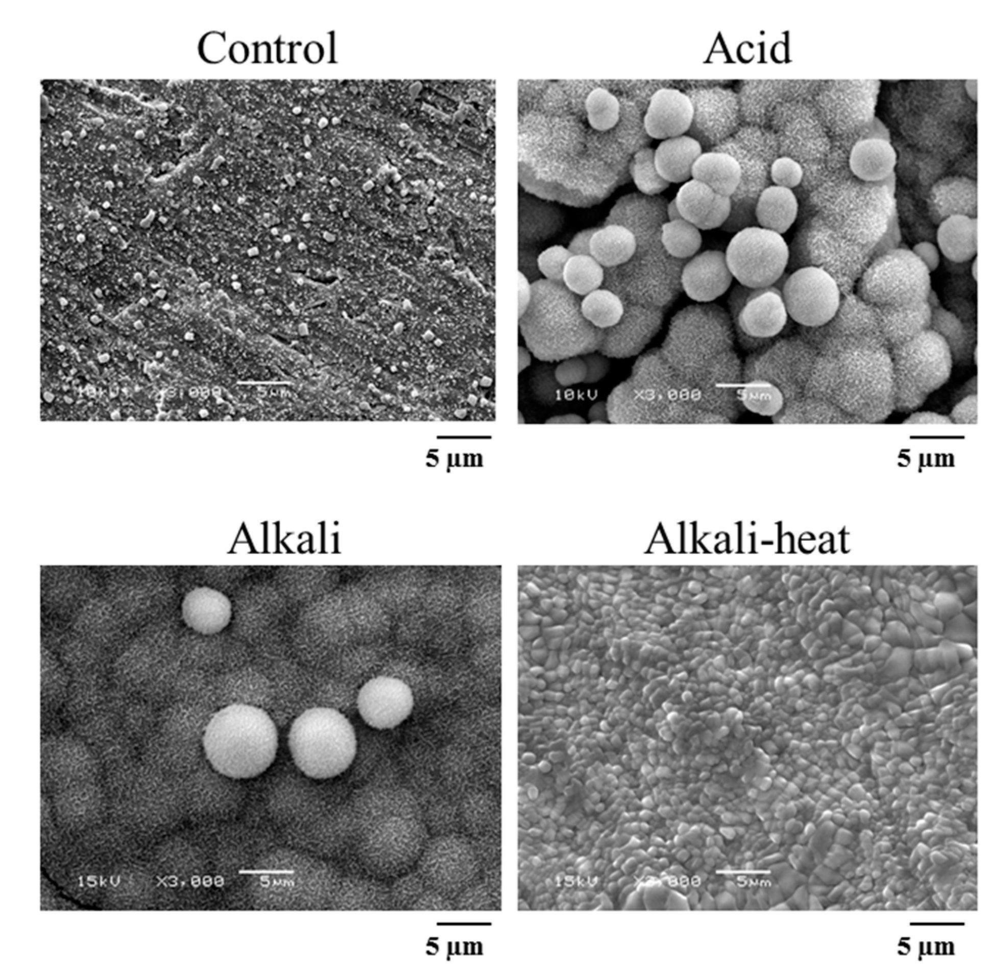 Metals 09 00230 g008