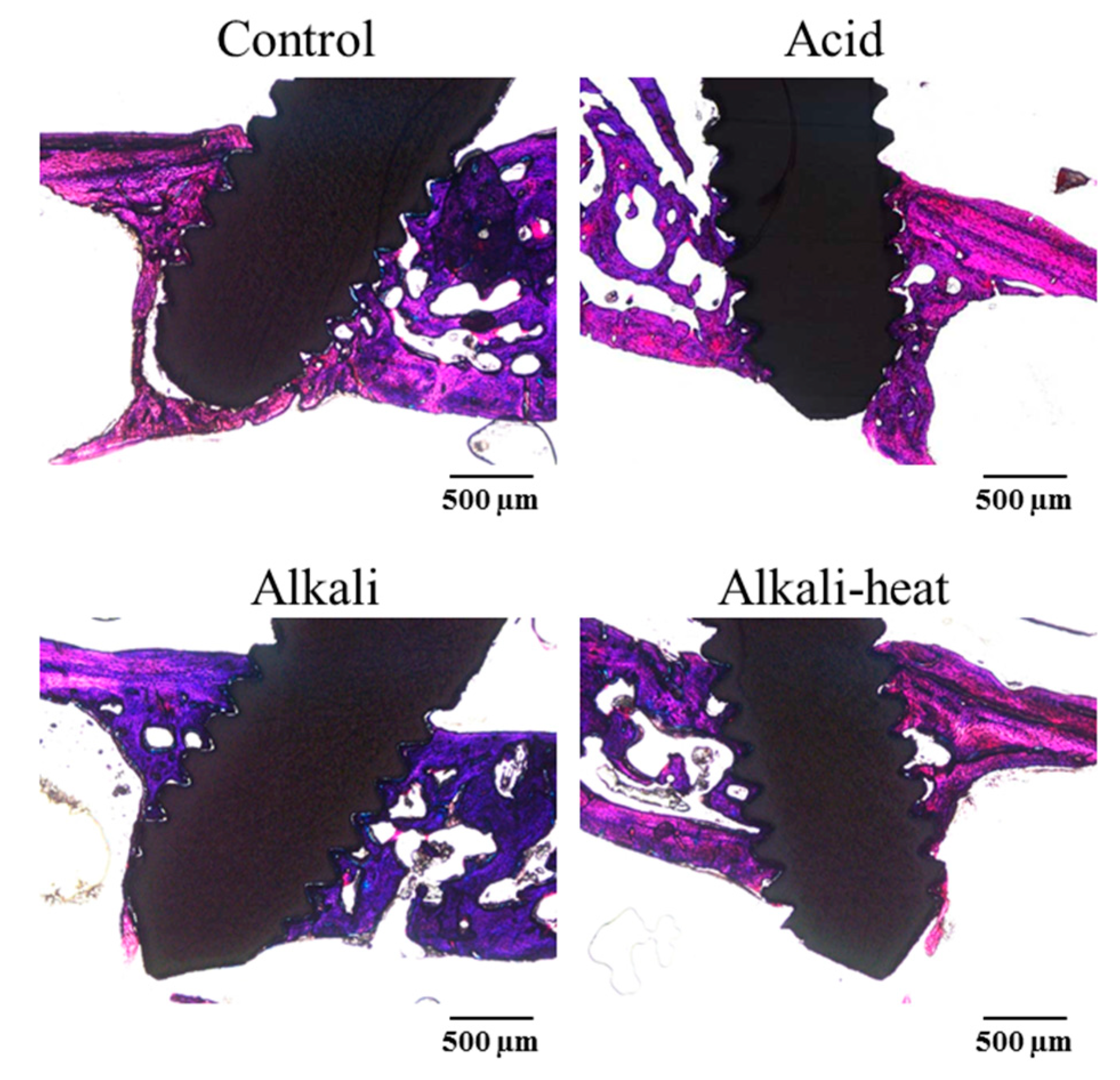 Metals 09 00230 g009