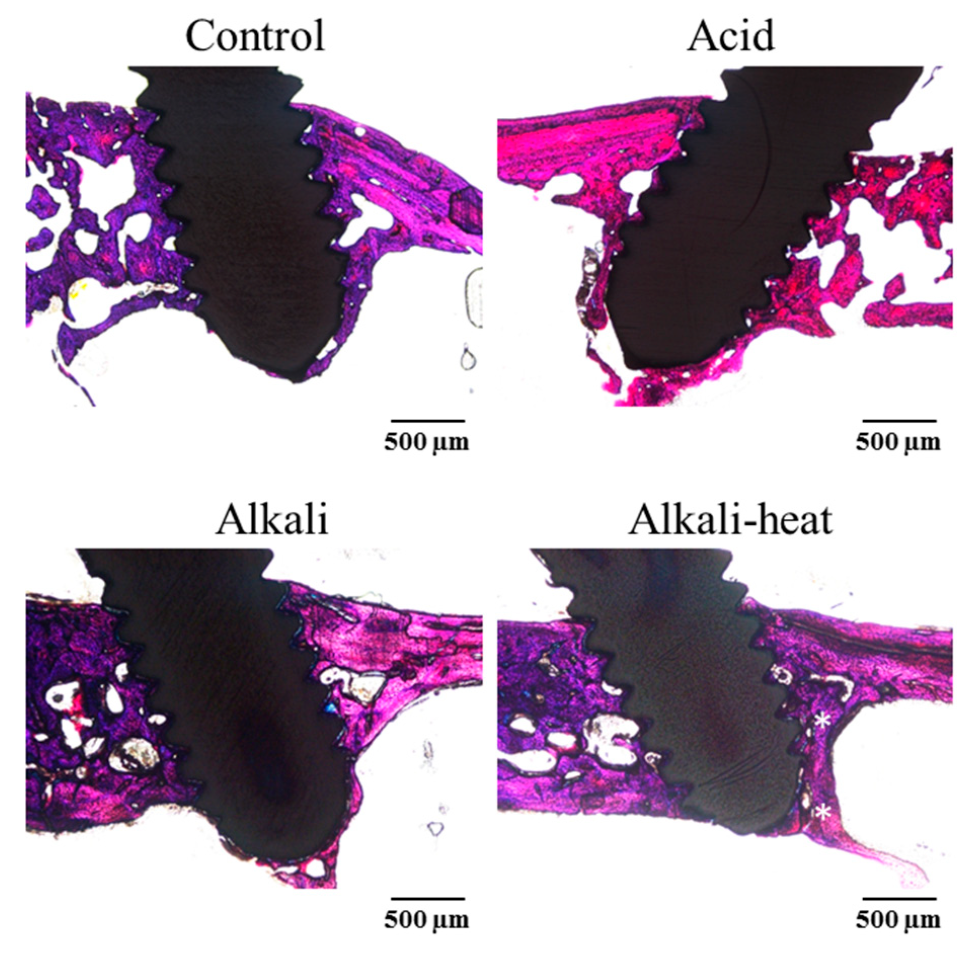 Metals 09 00230 g010