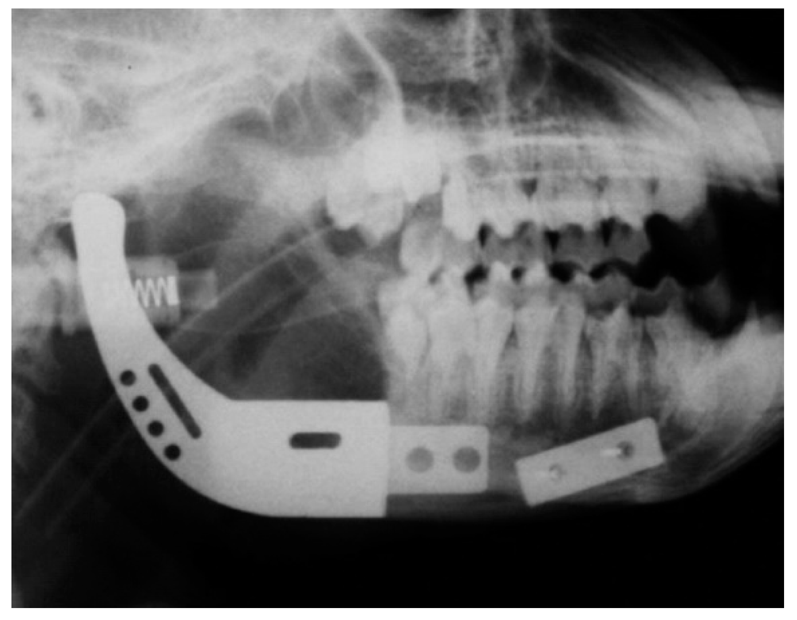 Metals 09 00302 g001