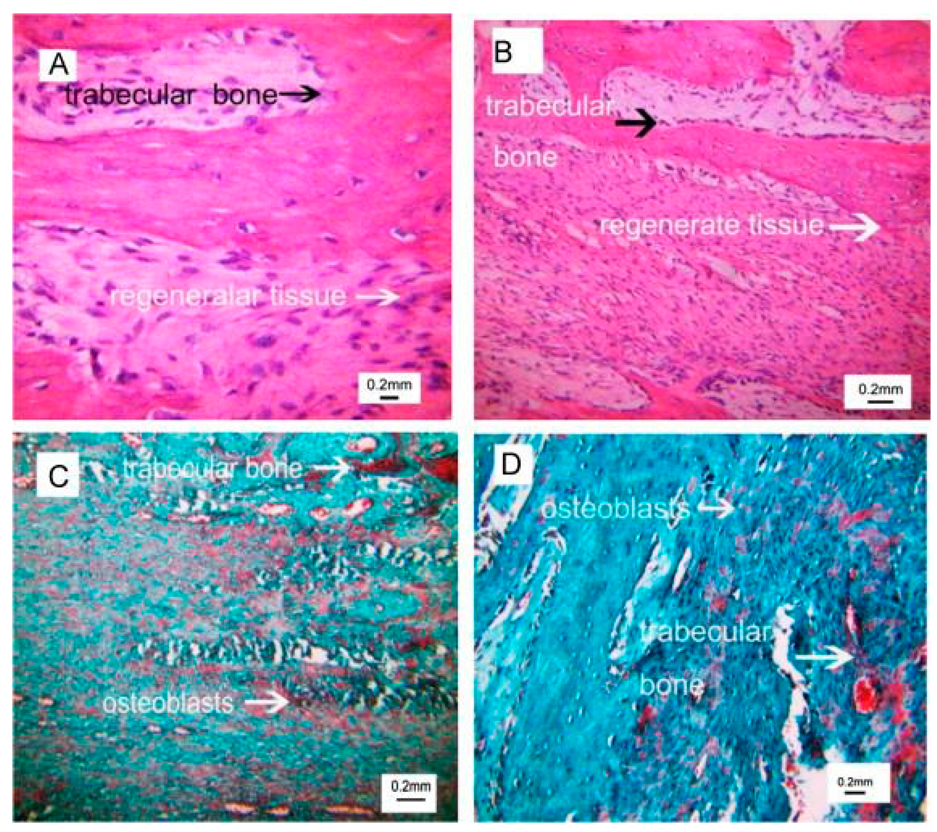 Metals 09 00302 g003
