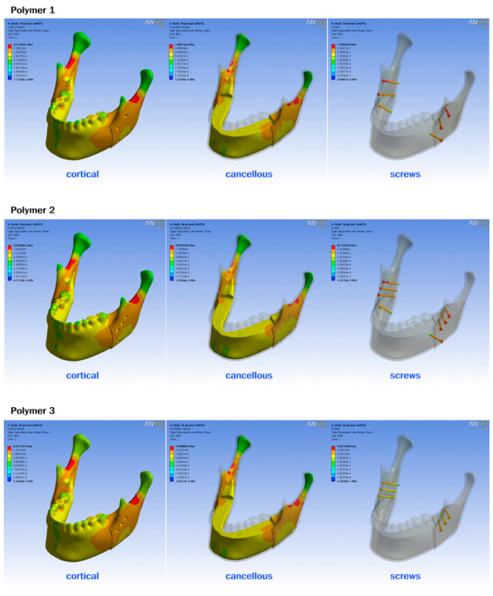 Metals 09 00302 g004
