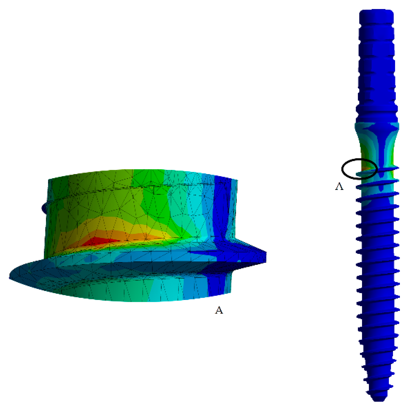 Metals 09 00535 g004 550