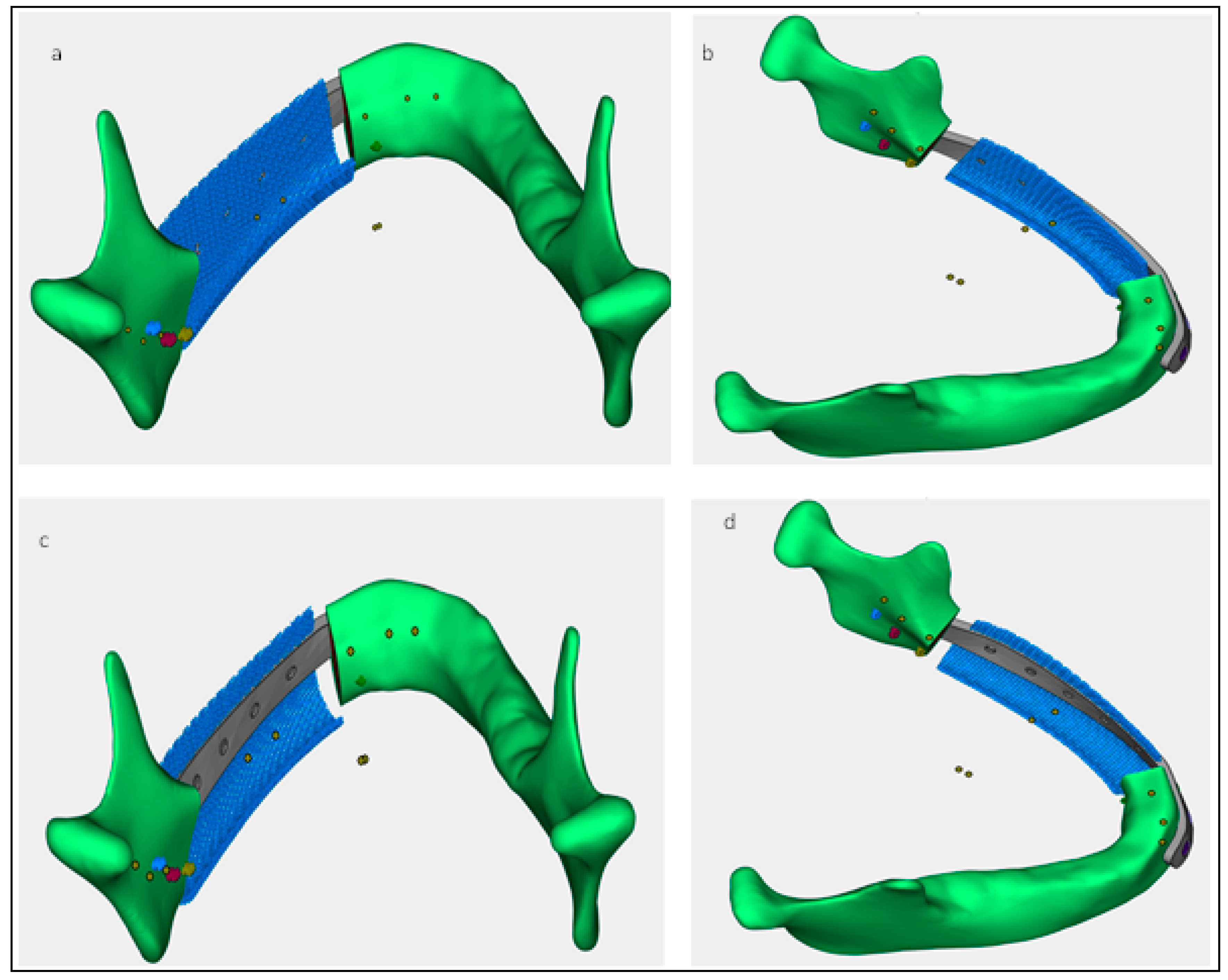 Metals 09 00569 g004