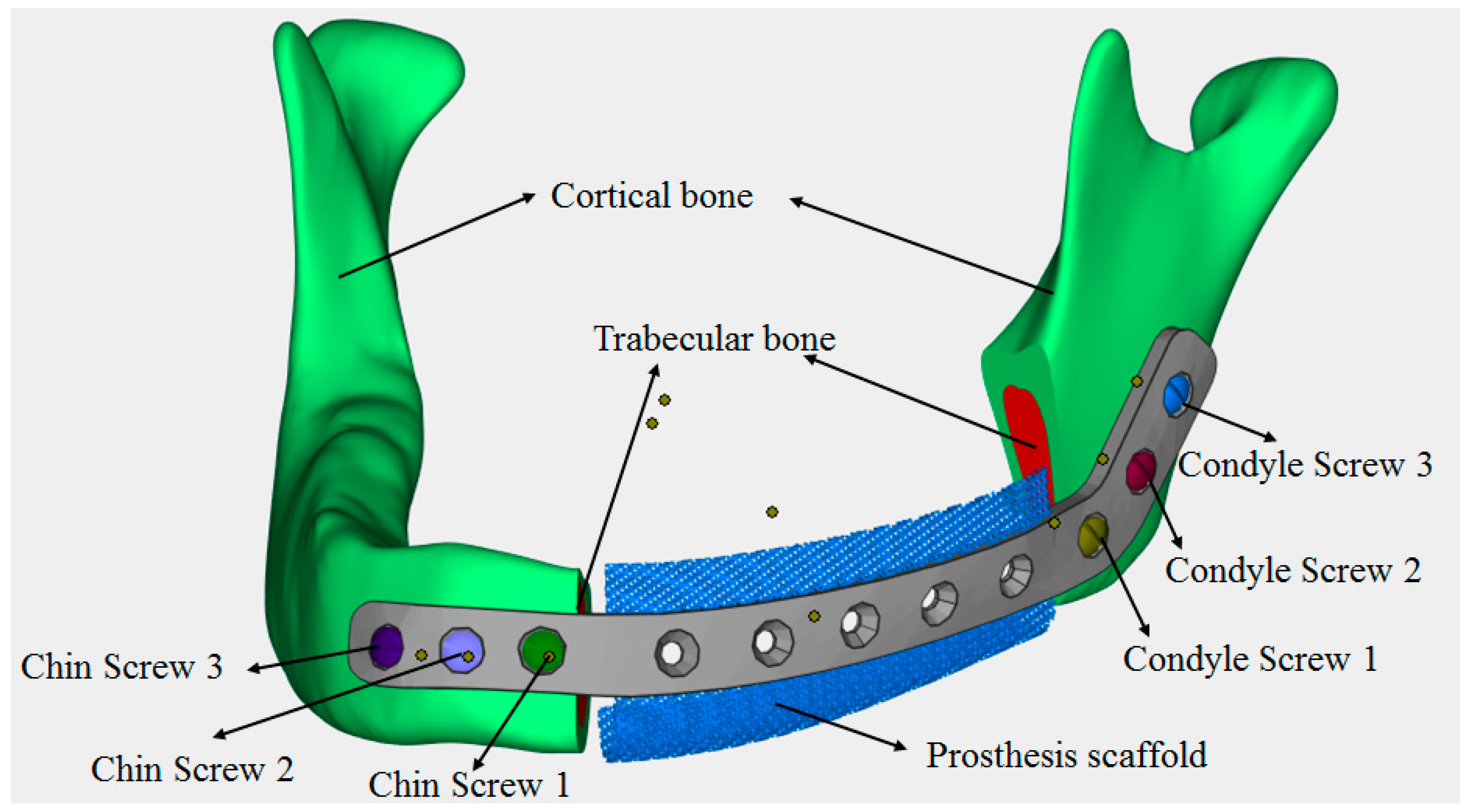 Metals 09 00569 g005