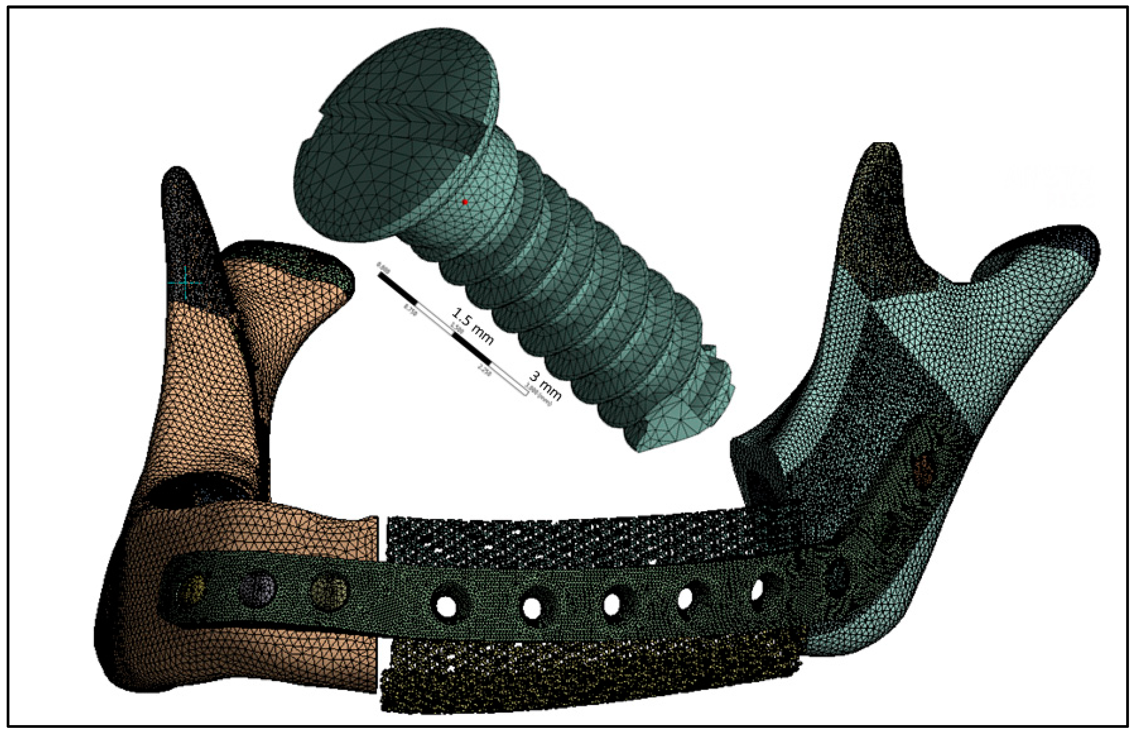 Metals 09 00569 g007