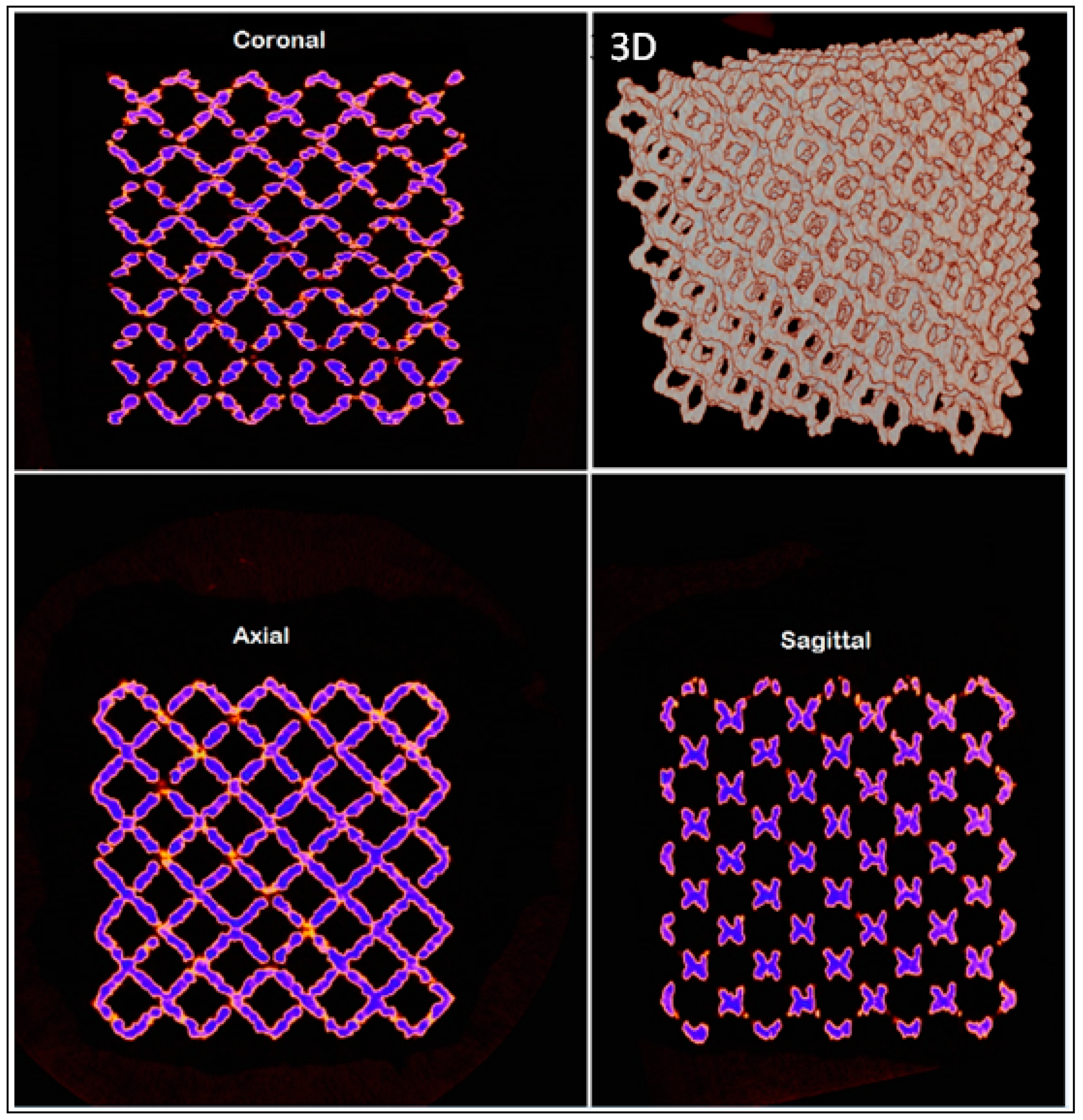 Metals 09 00569 g015