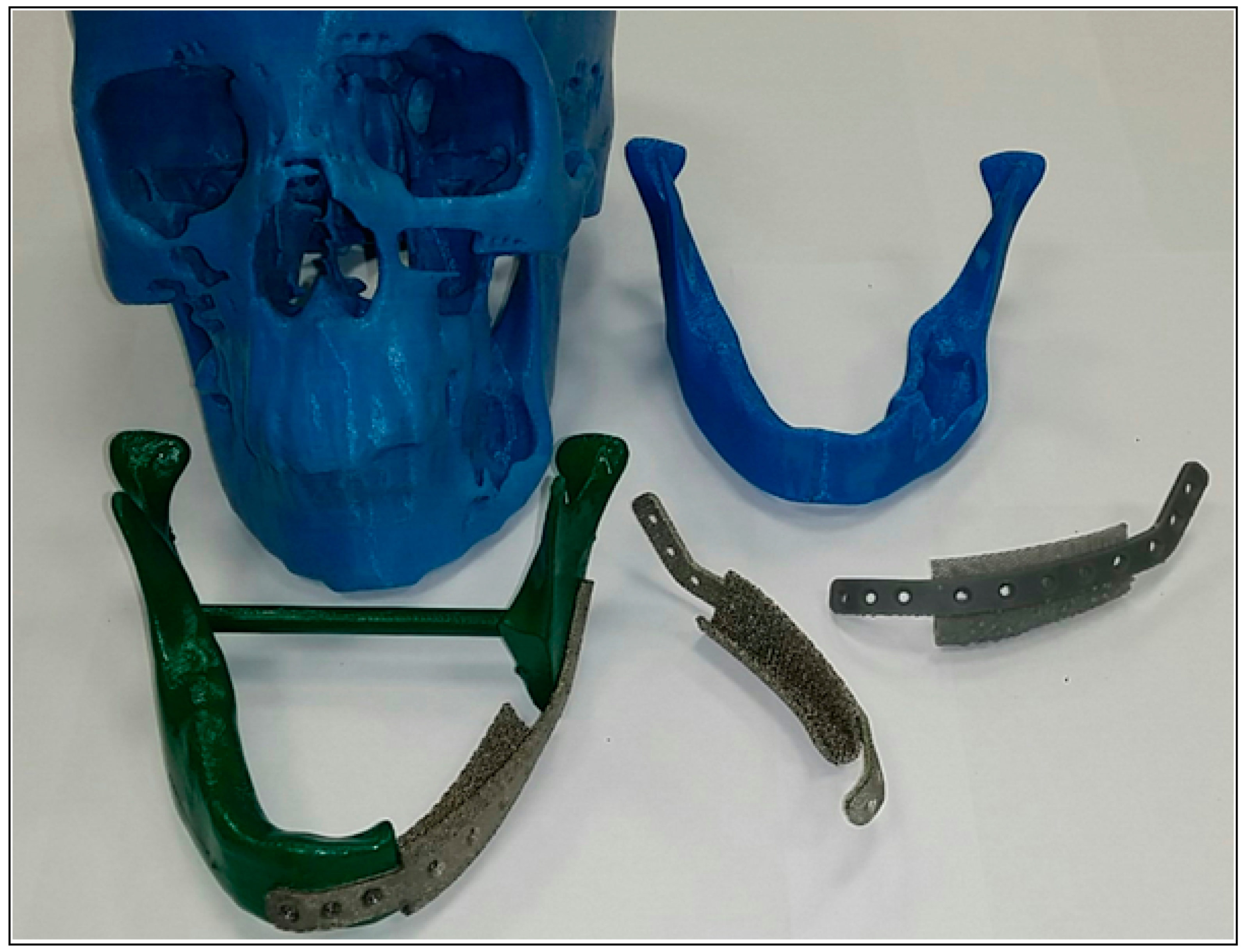 Metals 09 00569 g017