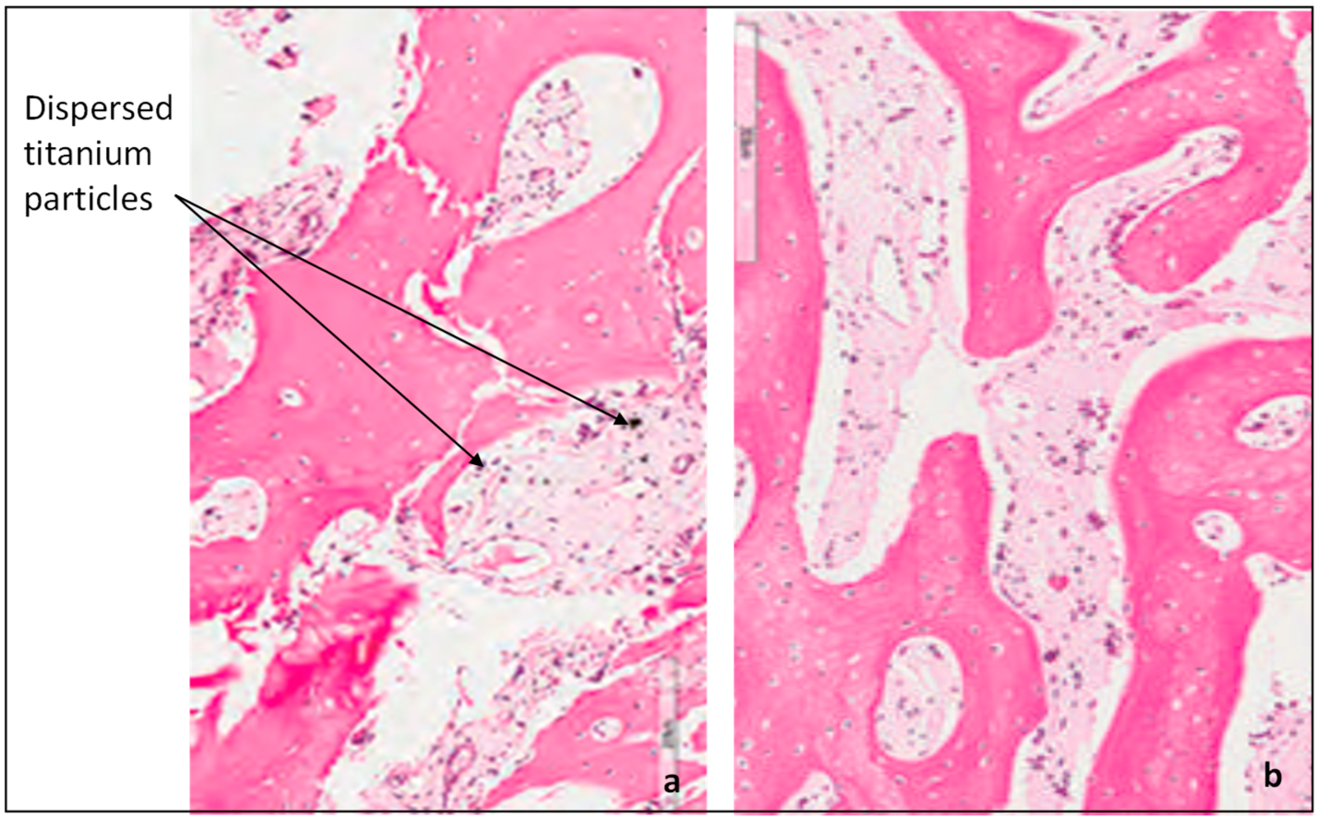 Metals 09 01065 g013