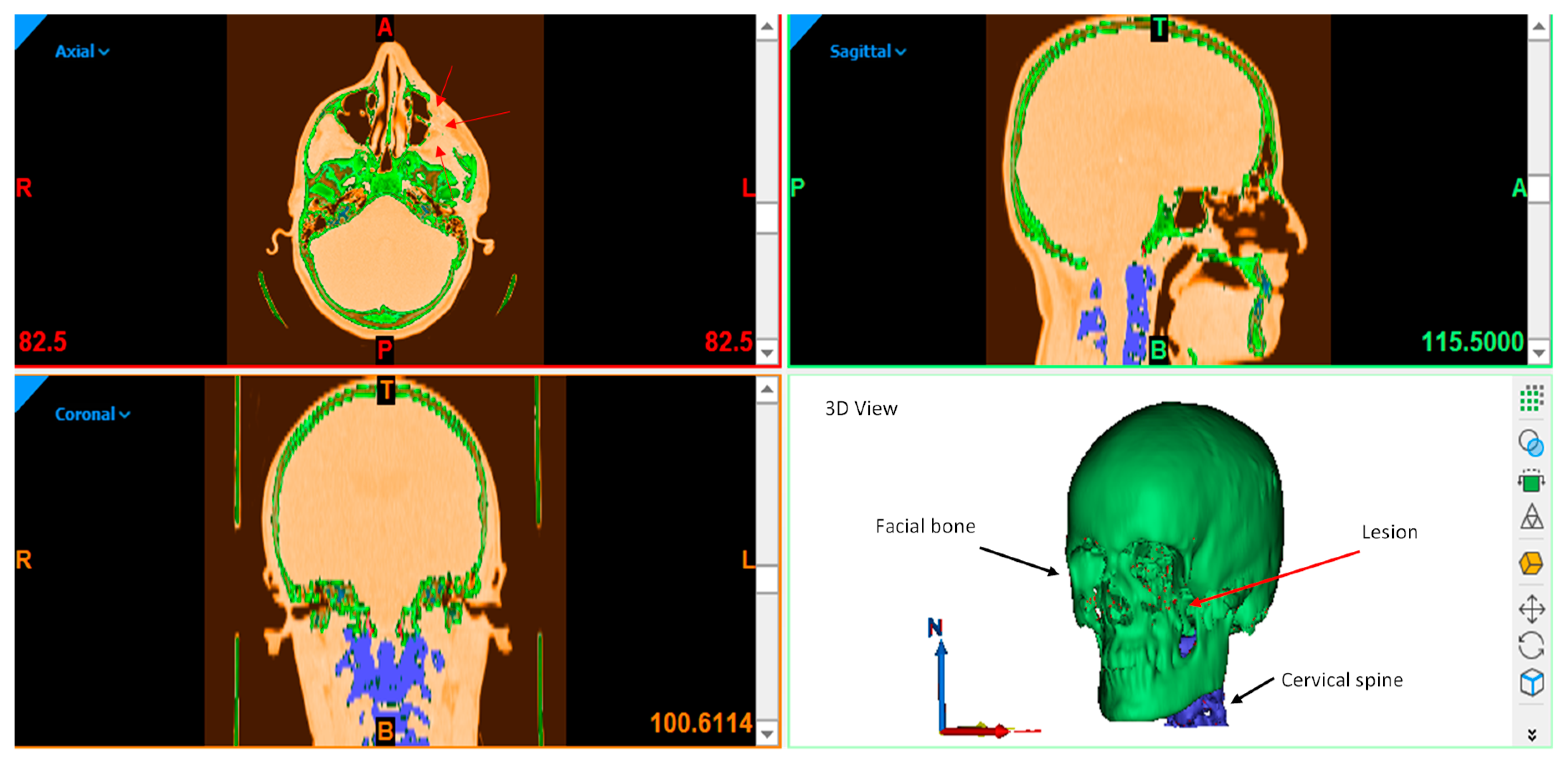 Metals 09 01250 g002 Metals 09 01250 g002