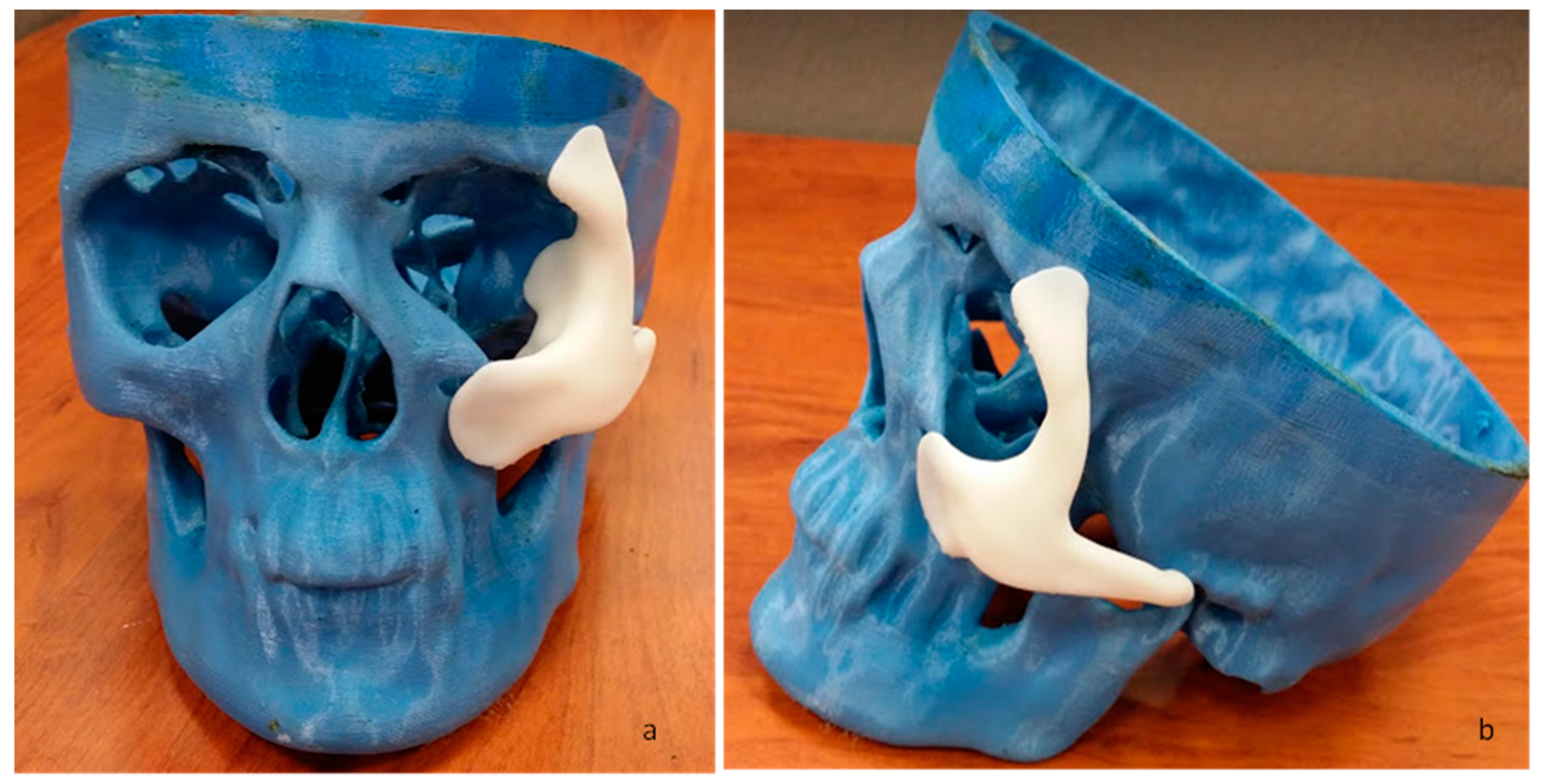 Metals 09 01250 g006 Metals 09 01250 g006