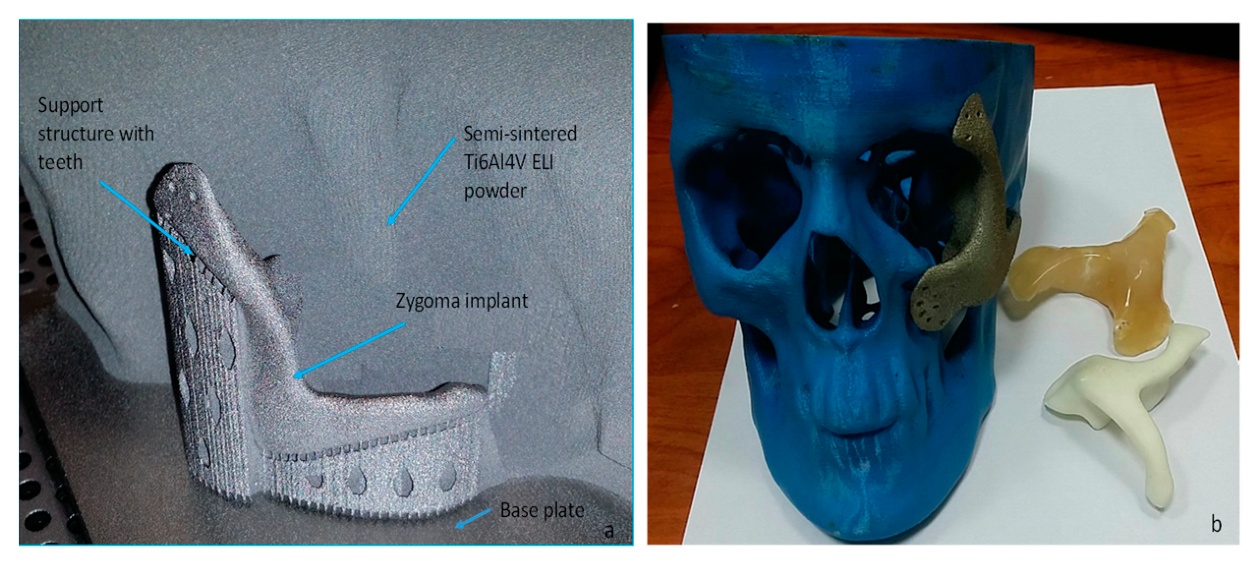 Metals 09 01250 g008 Metals 09 01250 g008