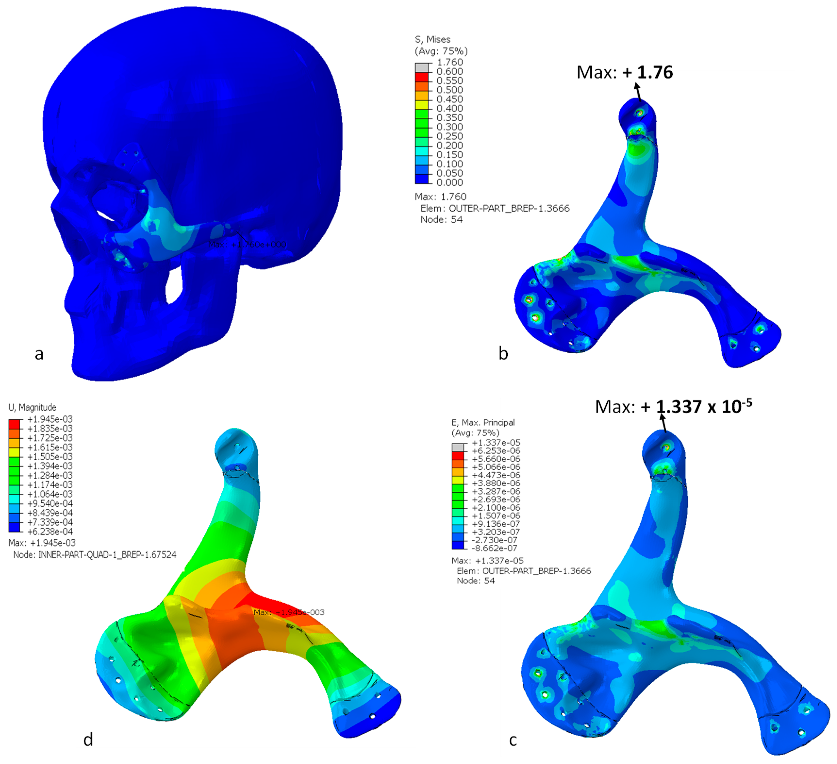 Metals 09 01250 g015 Metals 09 01250 g015