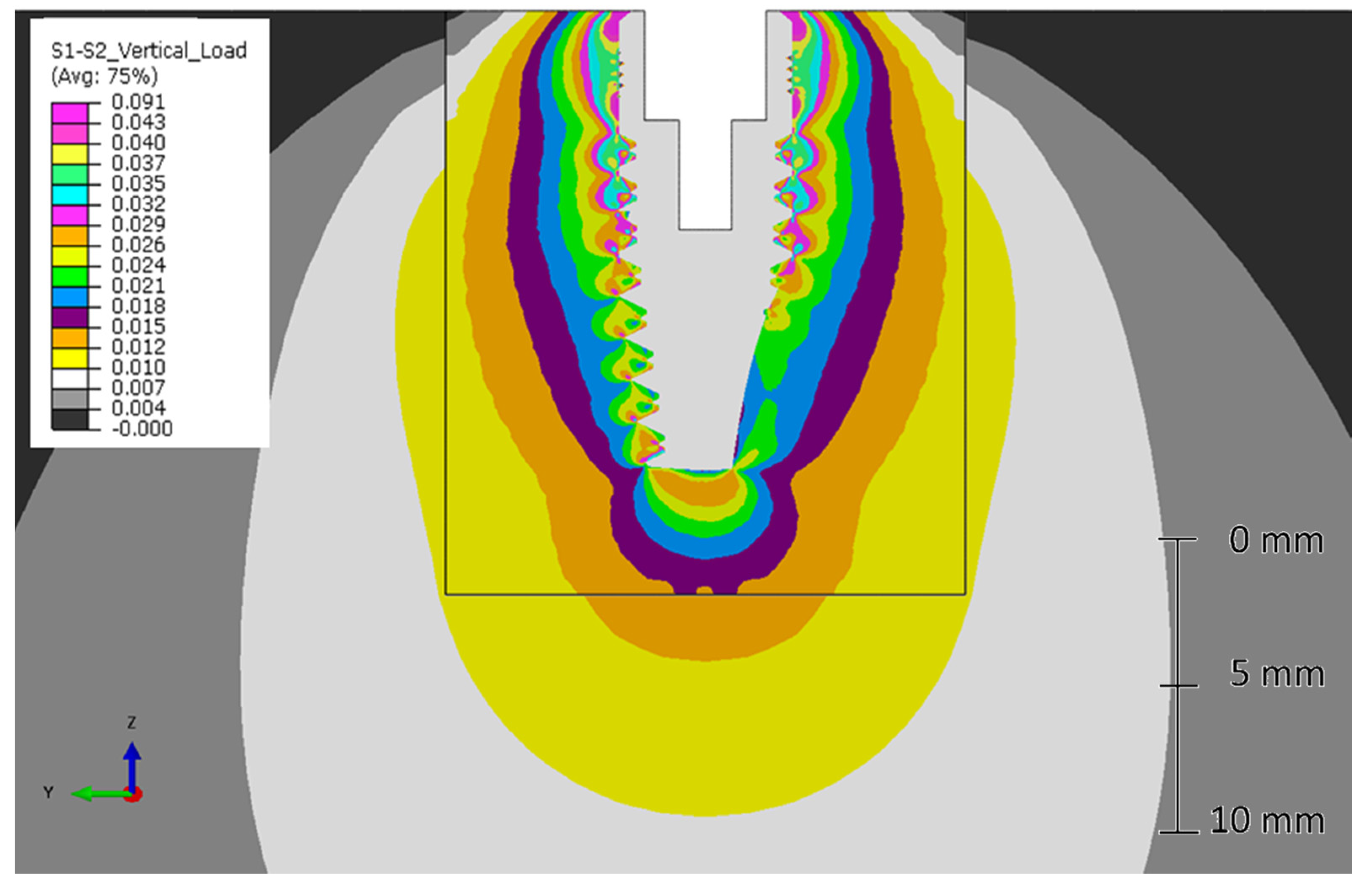 Metals 10 00648 g007