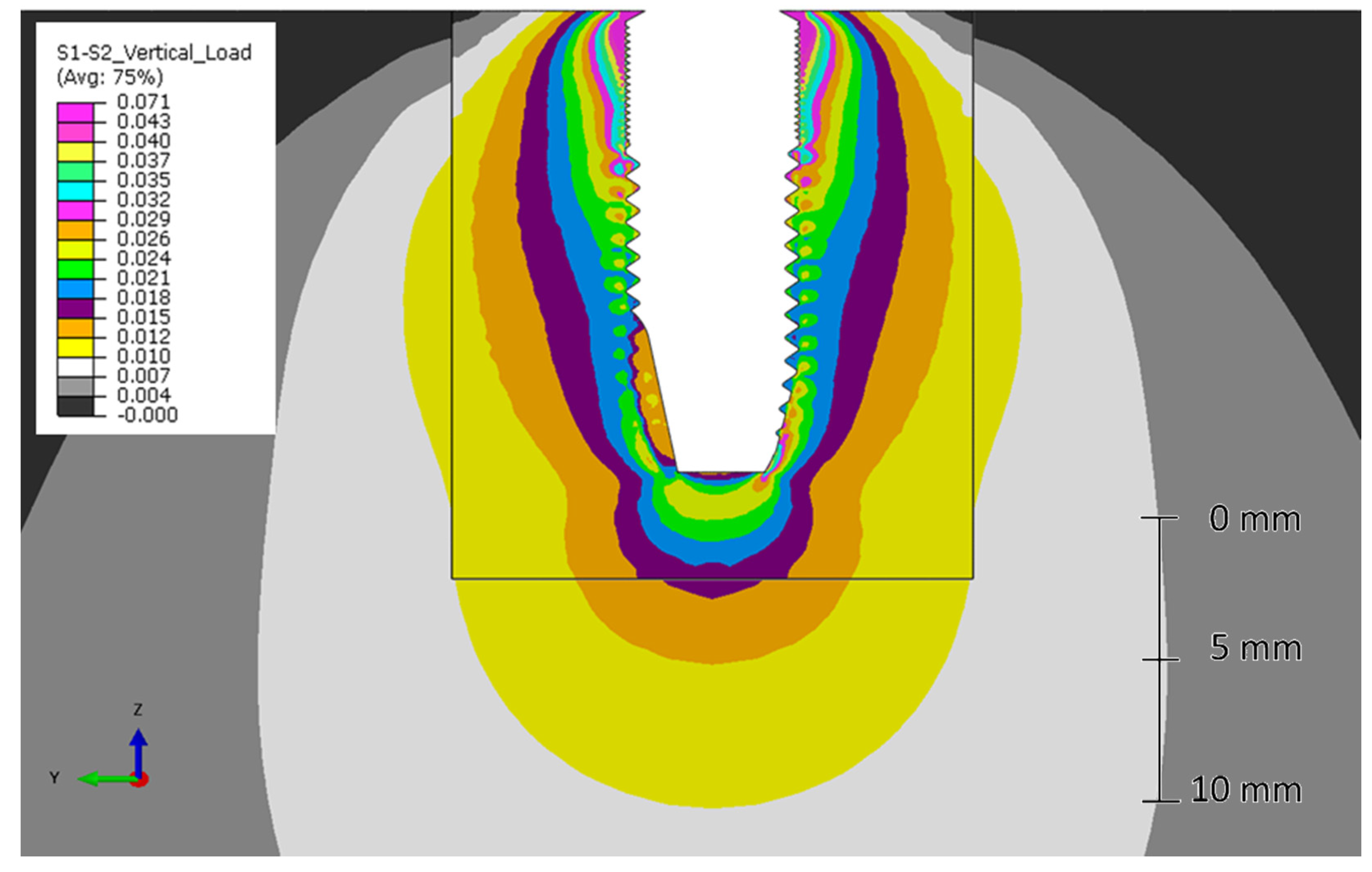 Metals 10 00648 g009