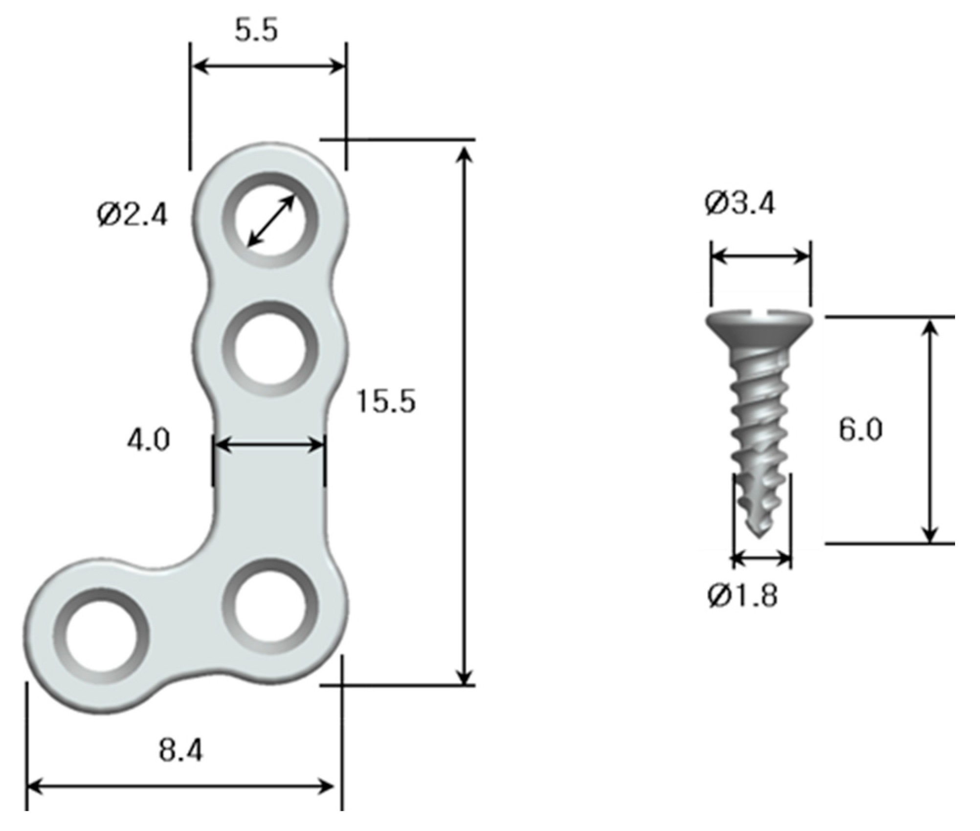 Metals 10 00724 g001 Metals 10 00724 g001