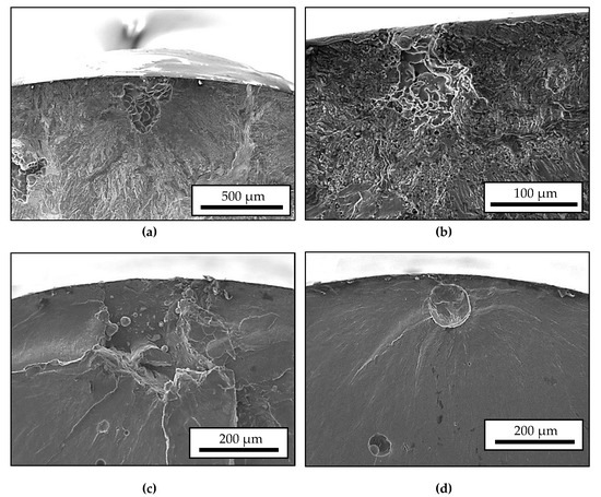 V.A. cataclastic fracture DEADLINE コンピCD An AI-Driven Framework for Detecting Bone Fractures in