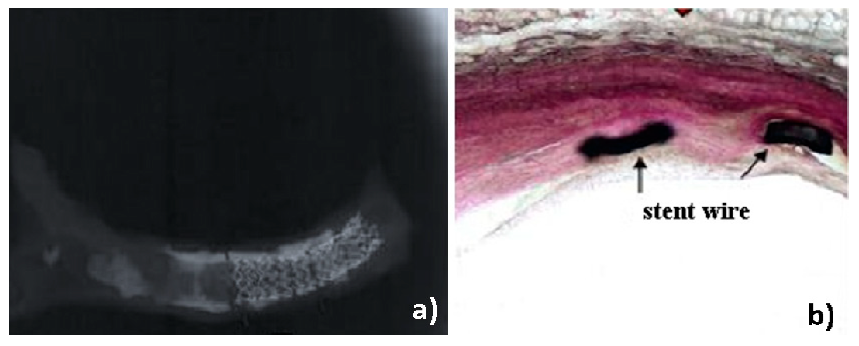 Metals 10 01112 g011 550