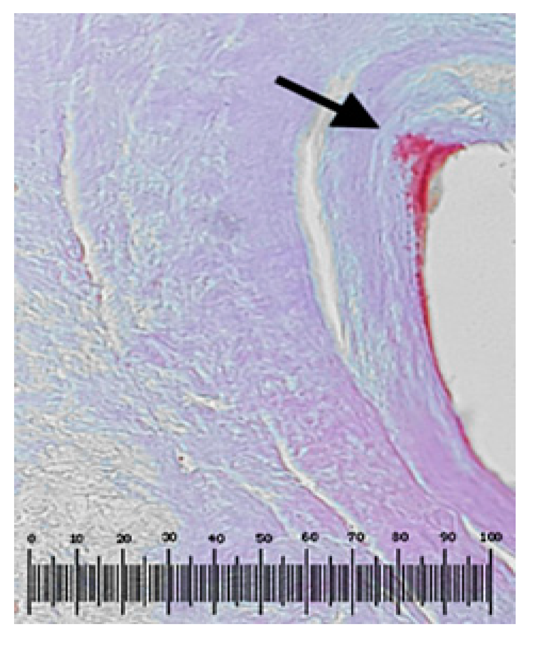 Metals 10 01112 g012 550