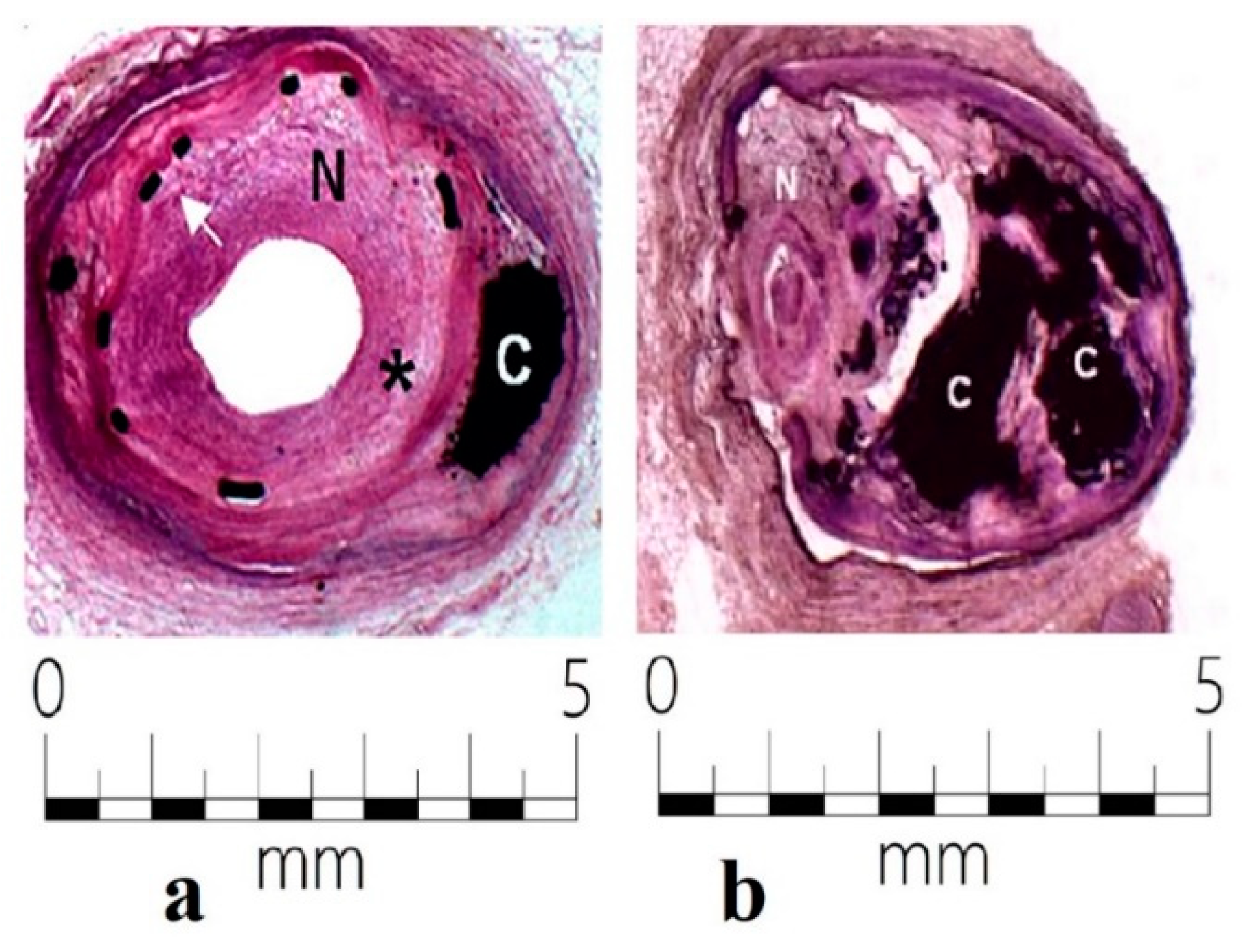 Metals 10 01112 g015 550