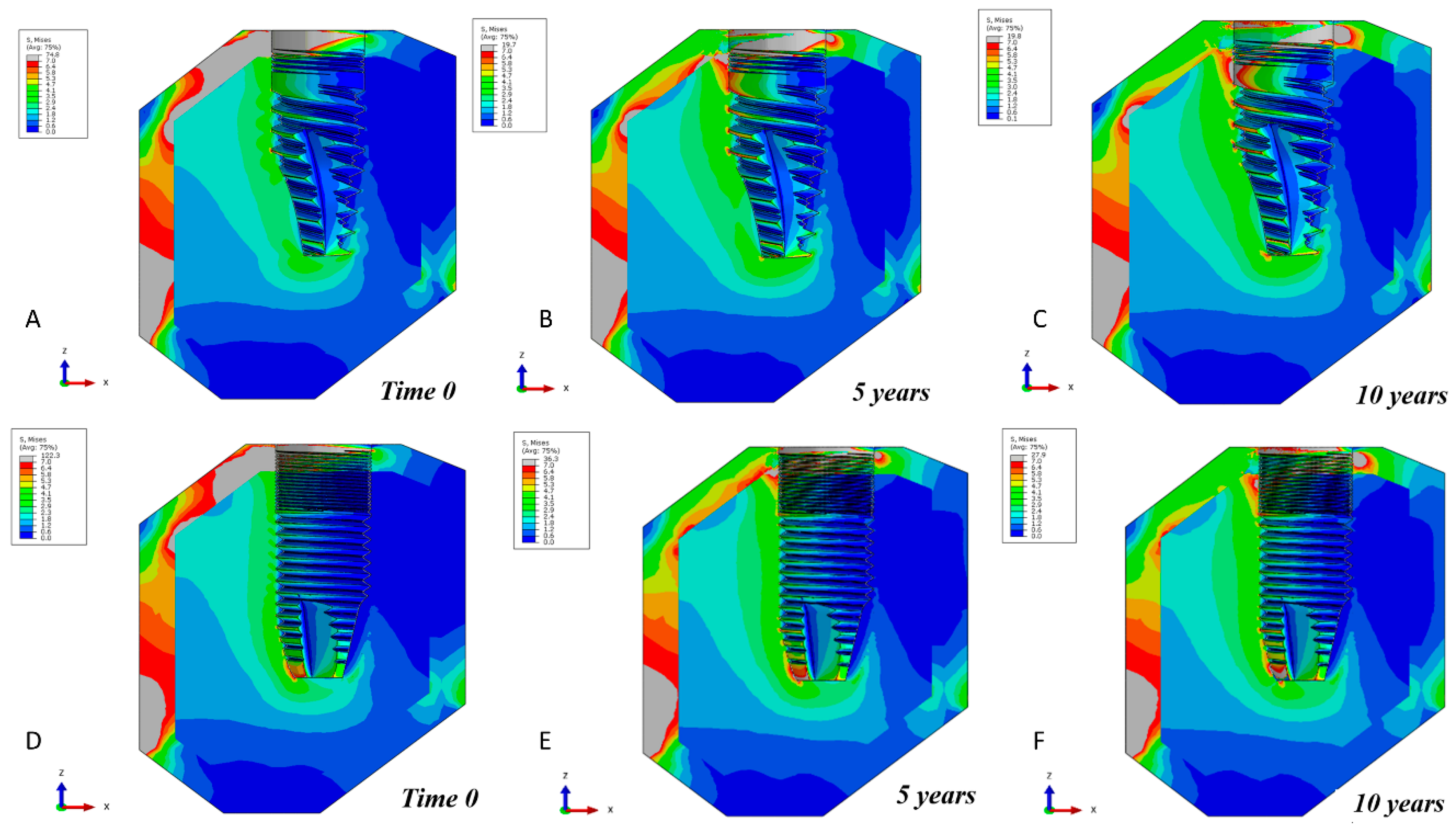 Metals 10 01132 g004