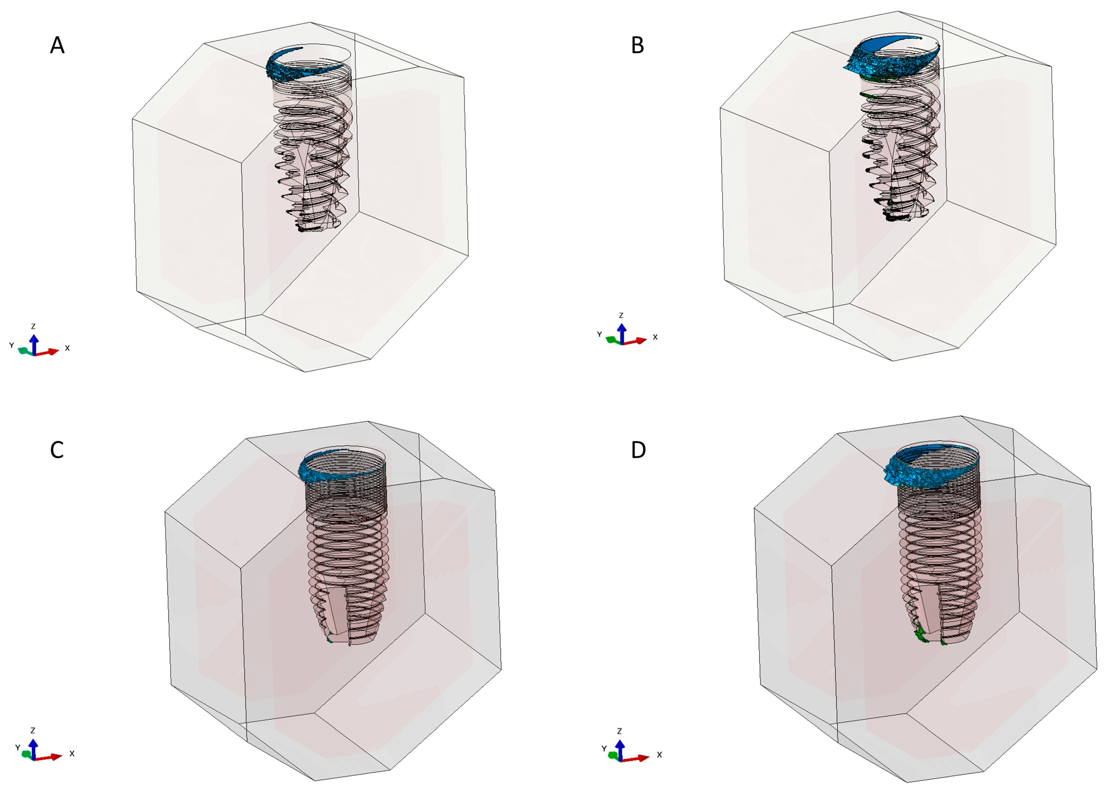 Metals 10 01132 g005