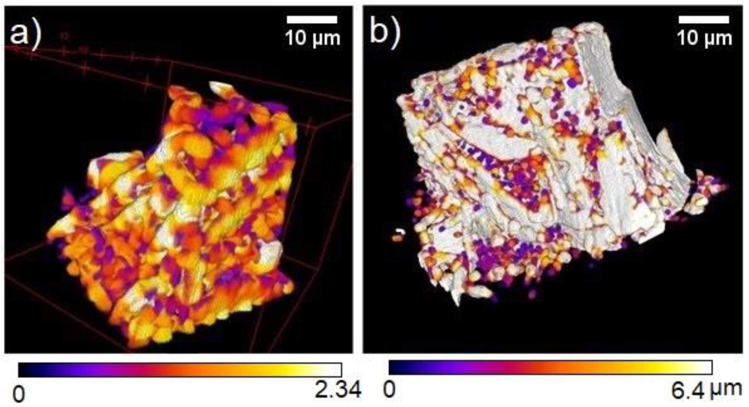 Metals 10 01450 g004