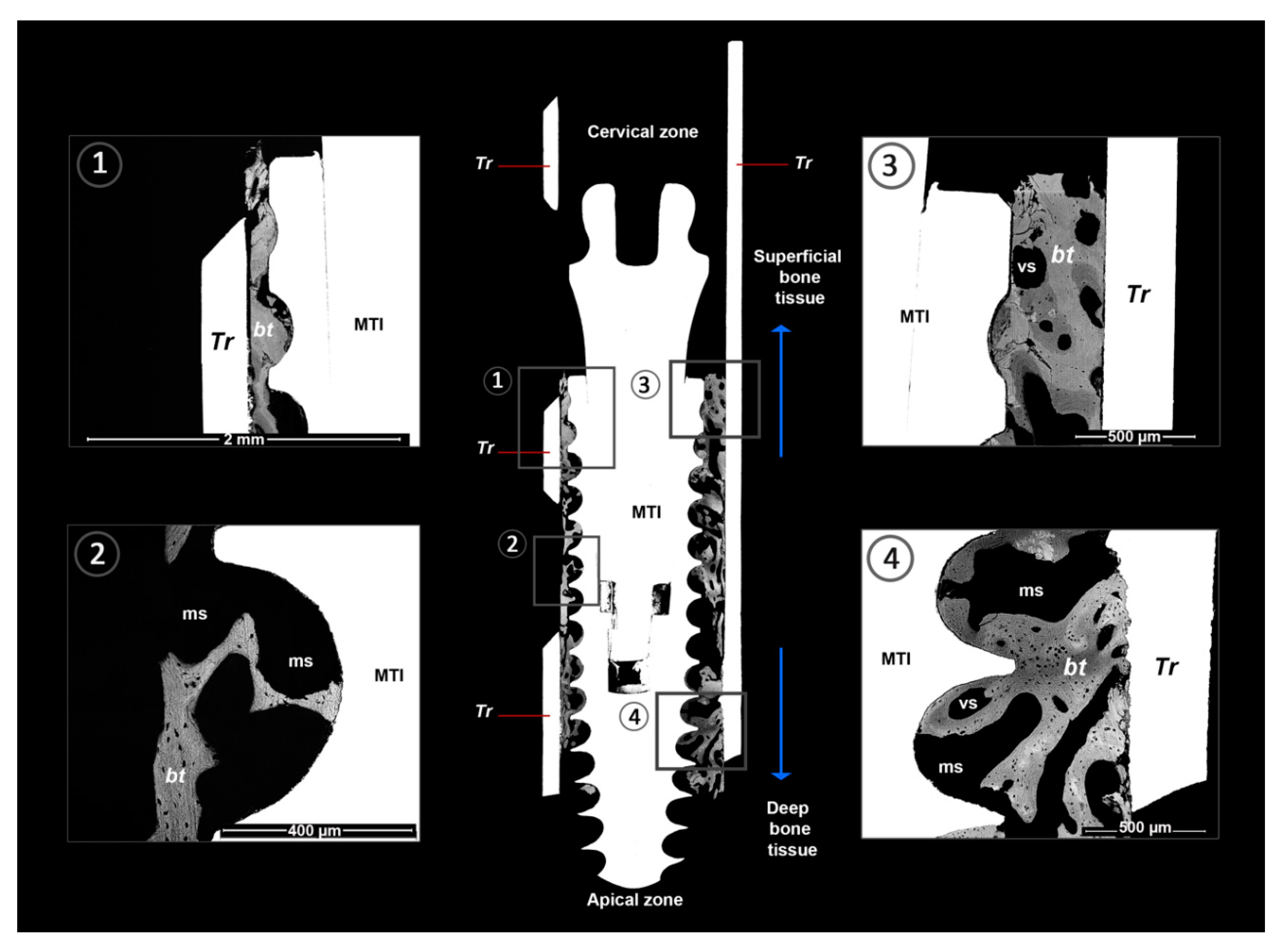 Metals 11 00002 g003
