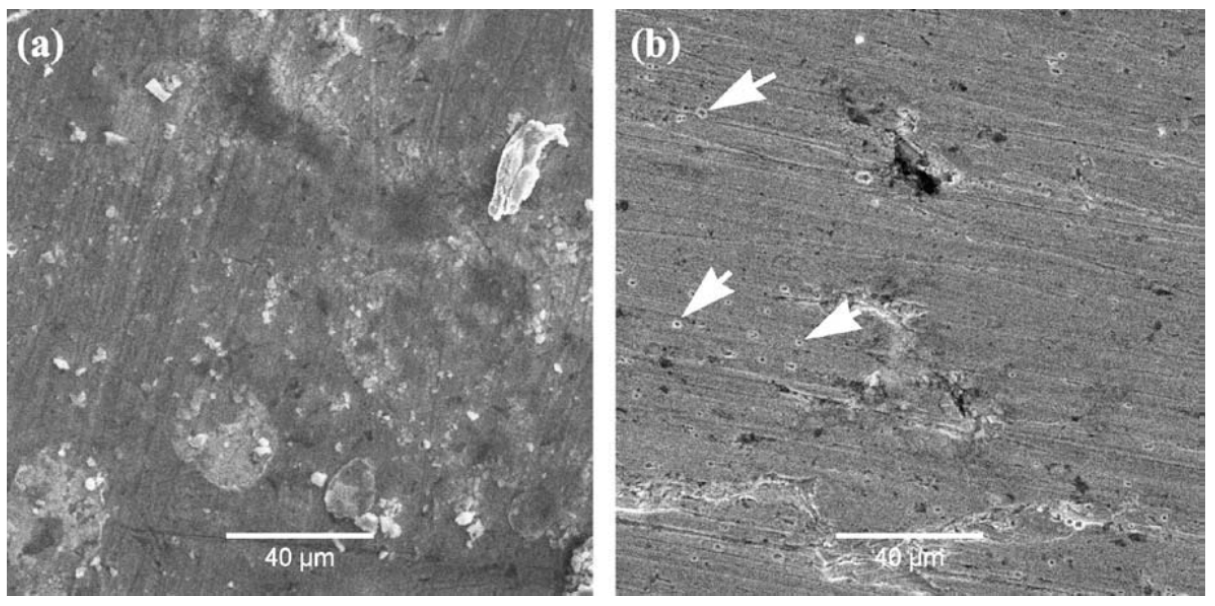 Metals 11 00287 g011