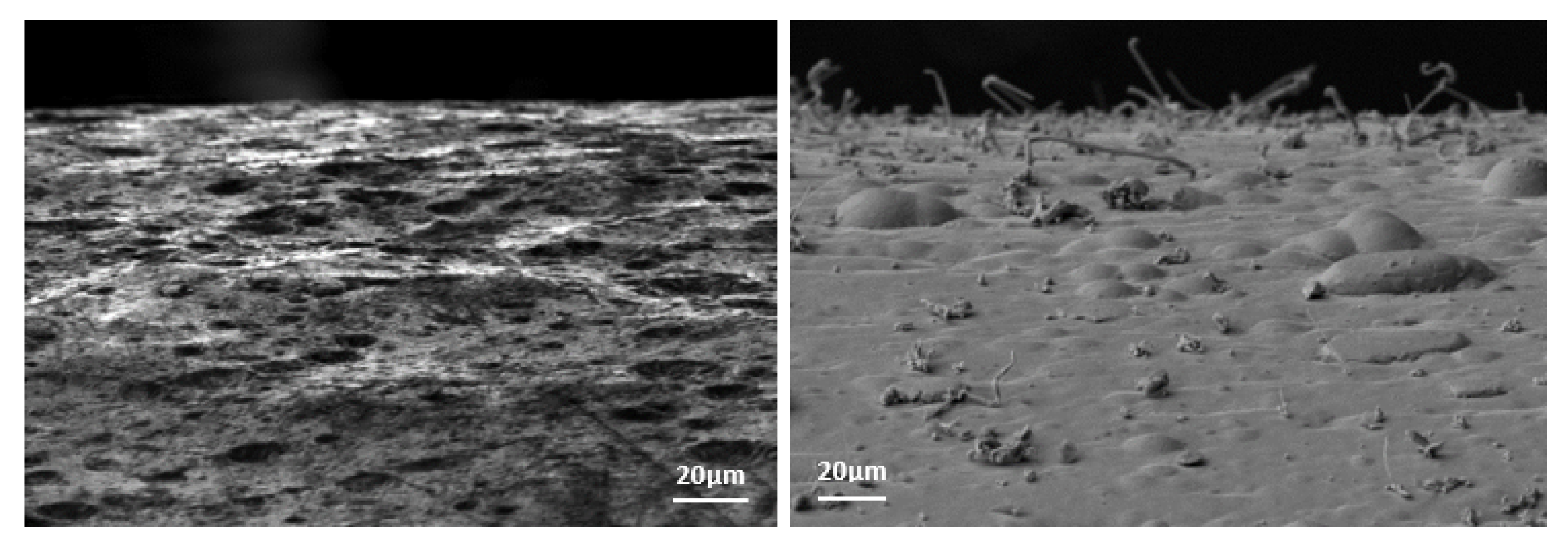 The formation of hillock with lateral grain growth: (a) vertical