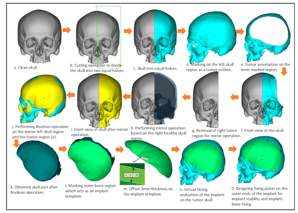 Metals 11 00496 g002