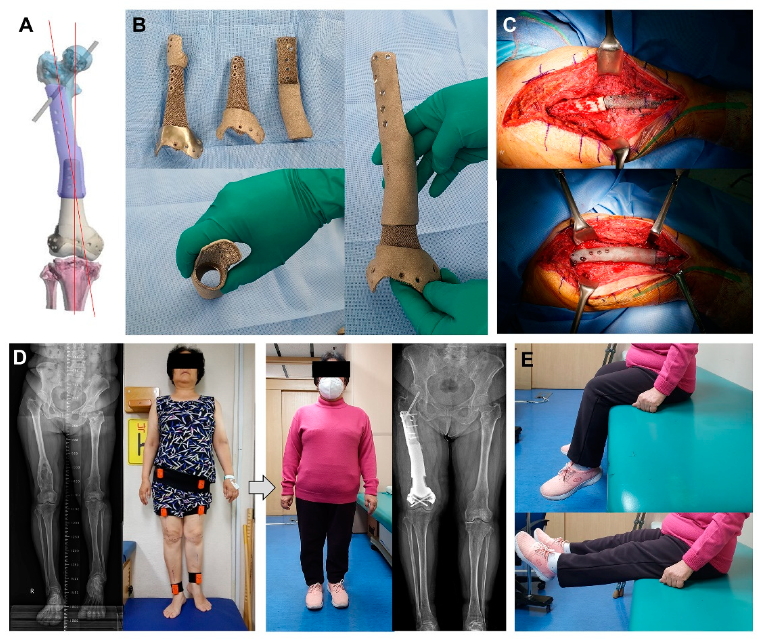 Metals 11 00707 g004