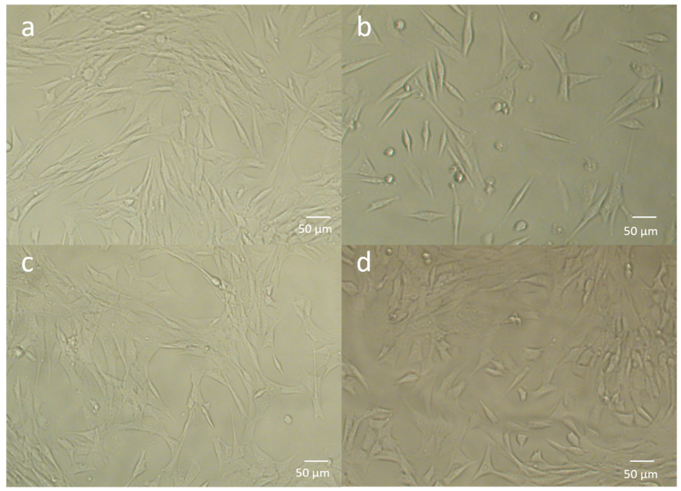 Metals 11 00784 g010