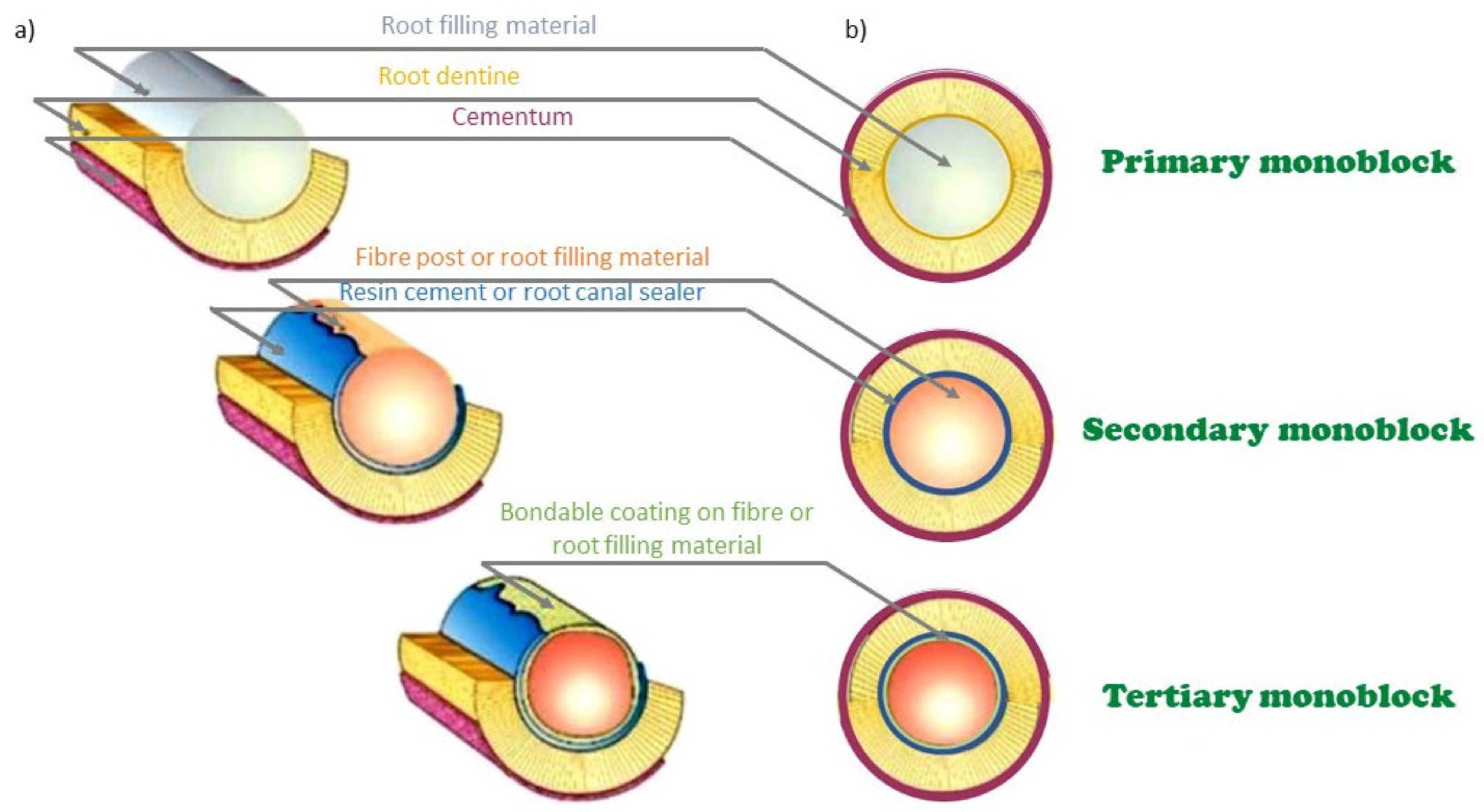 Filling material