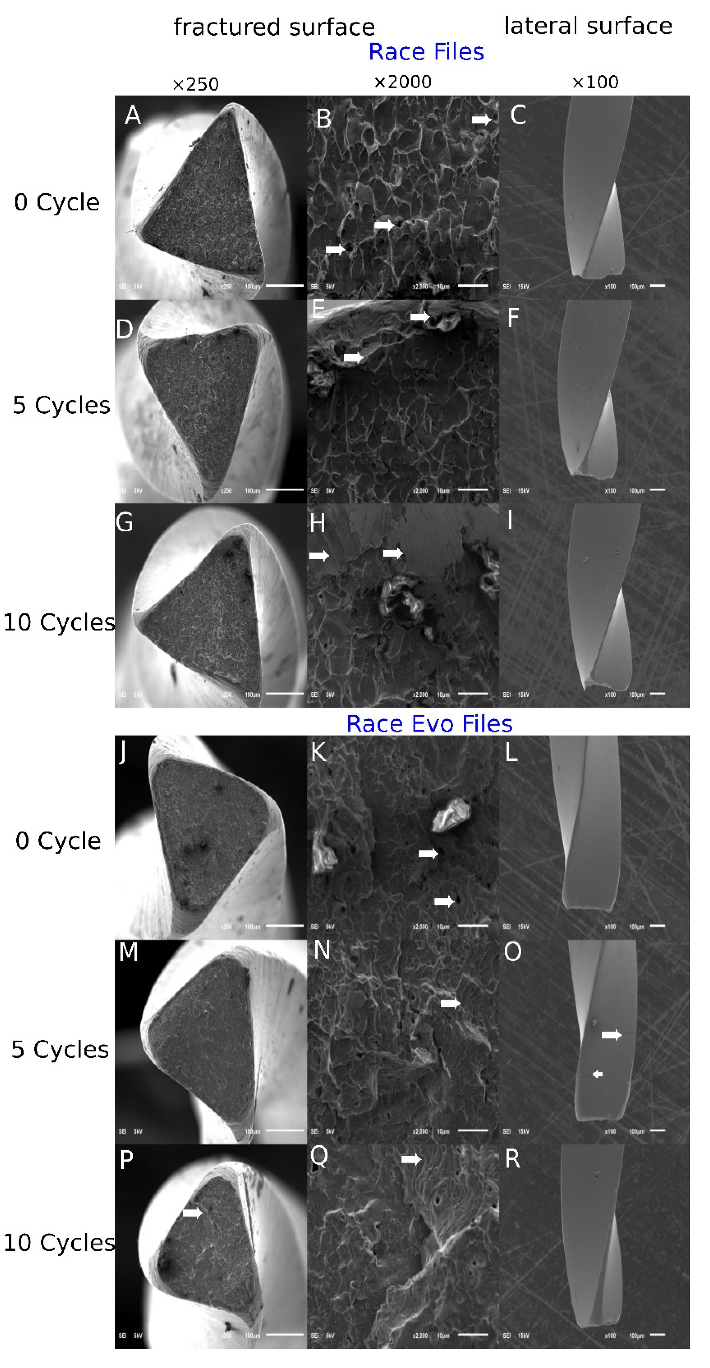 Metals 11 01947 g004